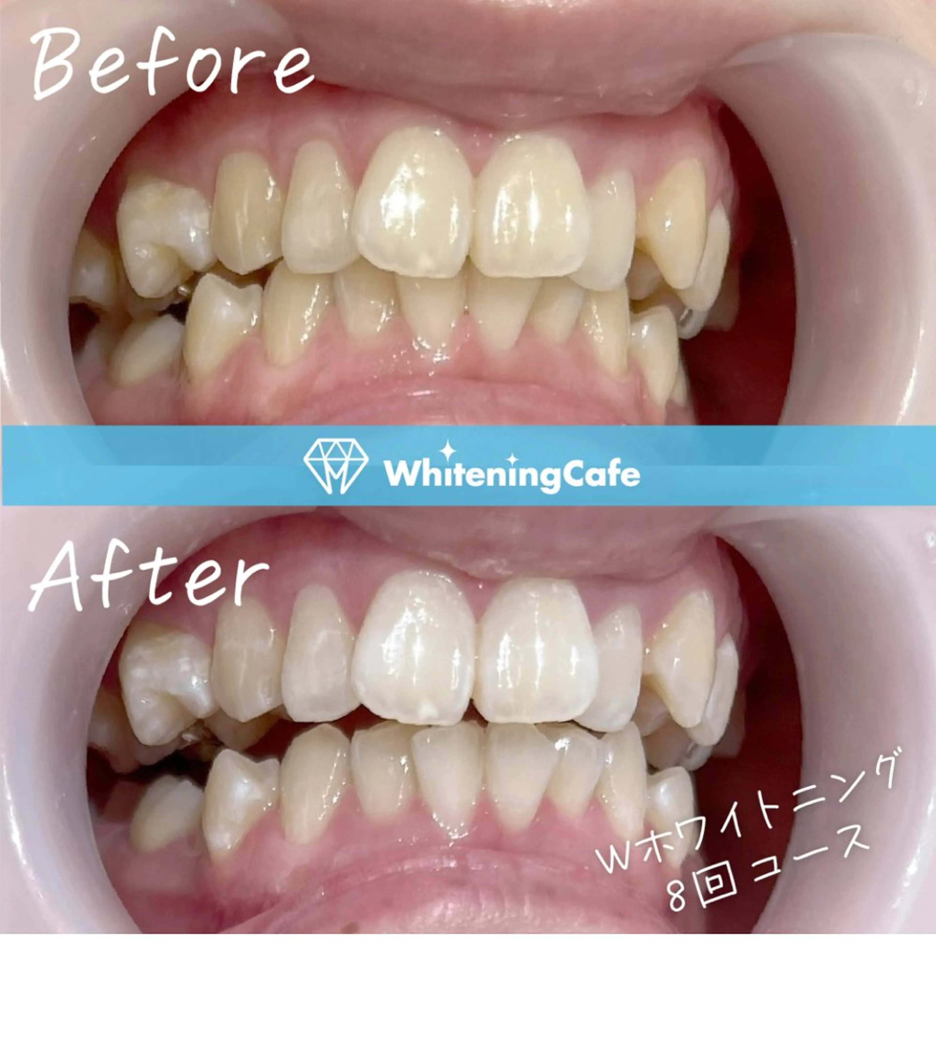 ホワイトニングカフェ荻窪店所属・ホワイトニングカフェ 荻窪店のその他イメージ