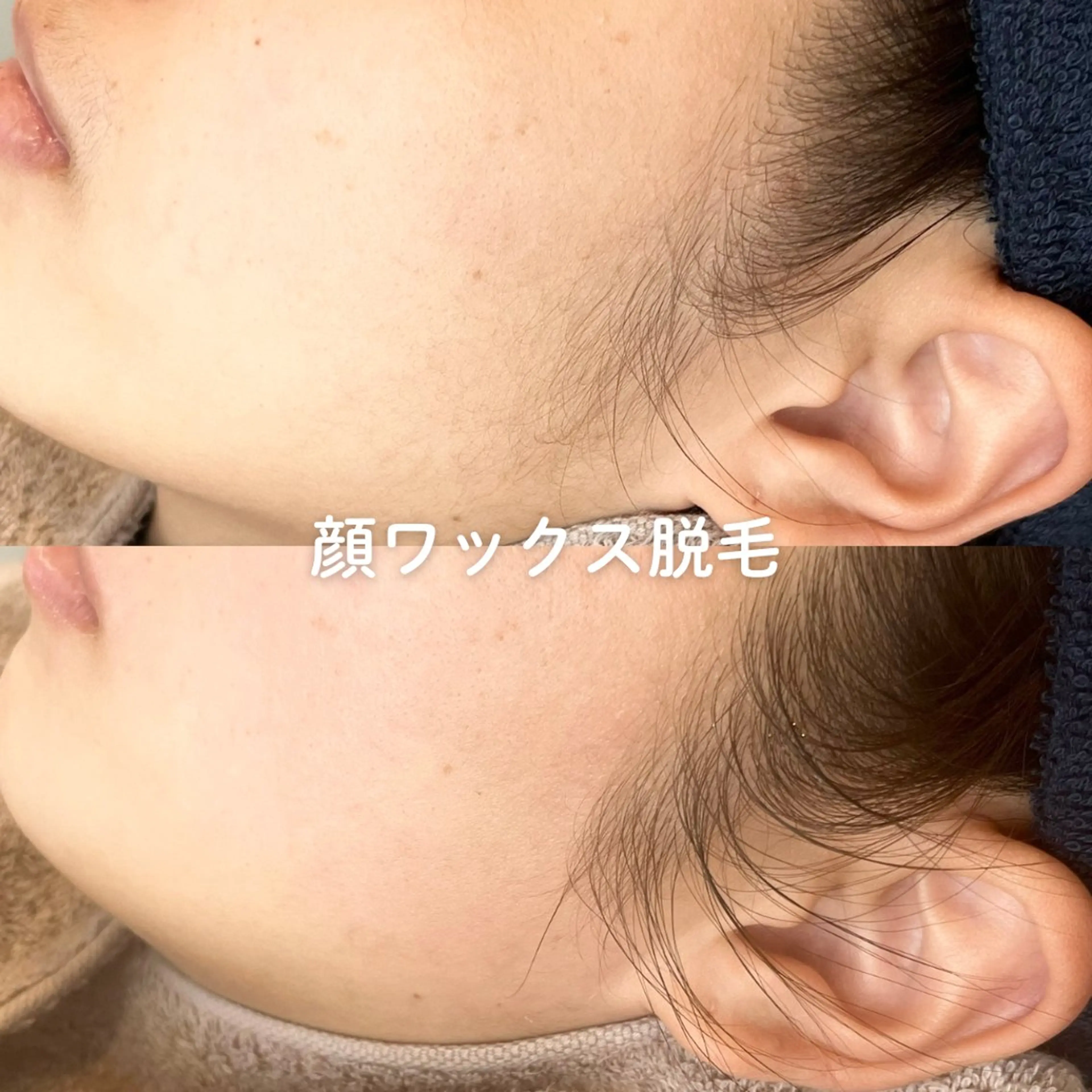 EST BEAUTY所属・顔ワックス脱毛/ ハーブピーリングのエステ・リラクイメージ