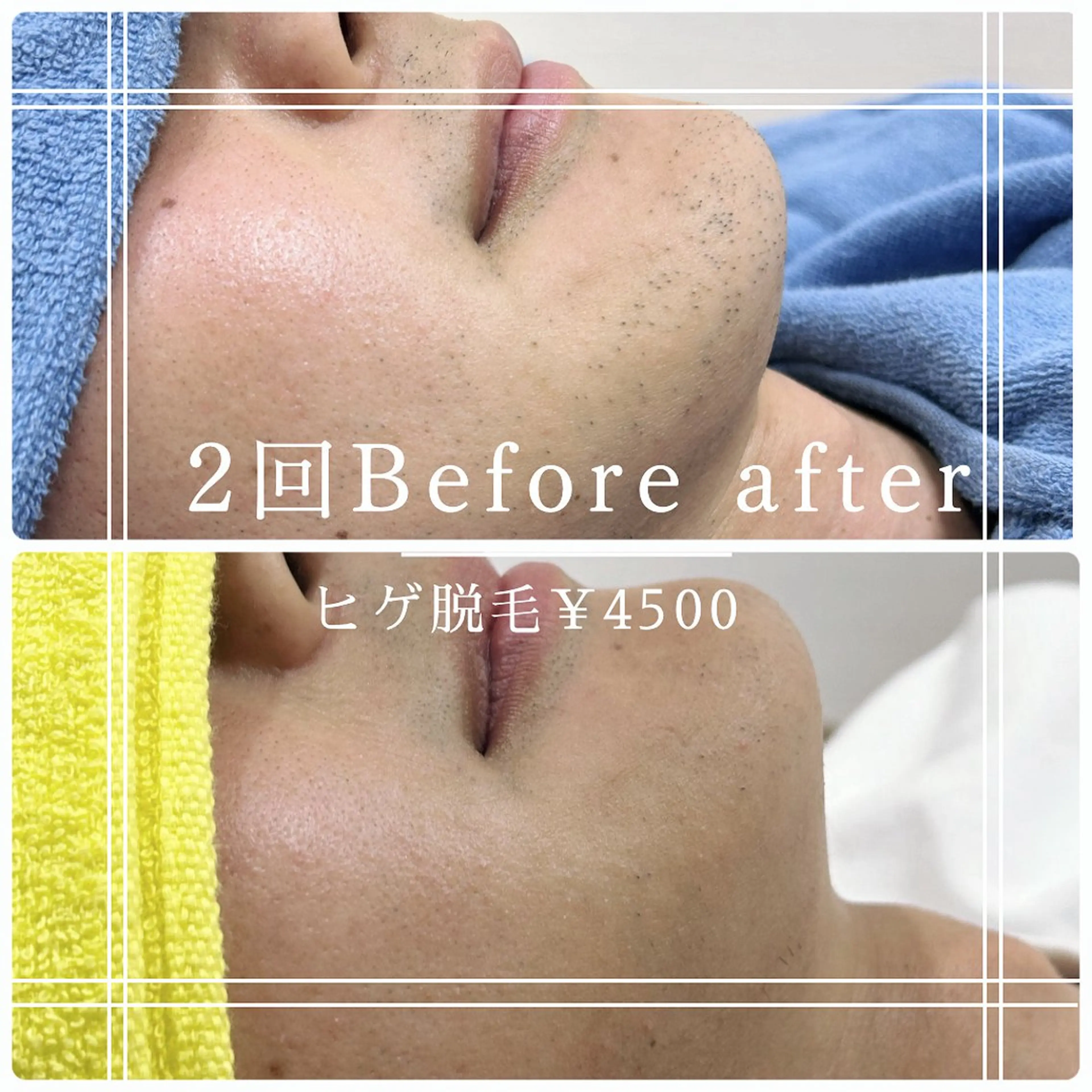 メンズ 脱毛 片田 ゆいのエステ・リラクイメージ