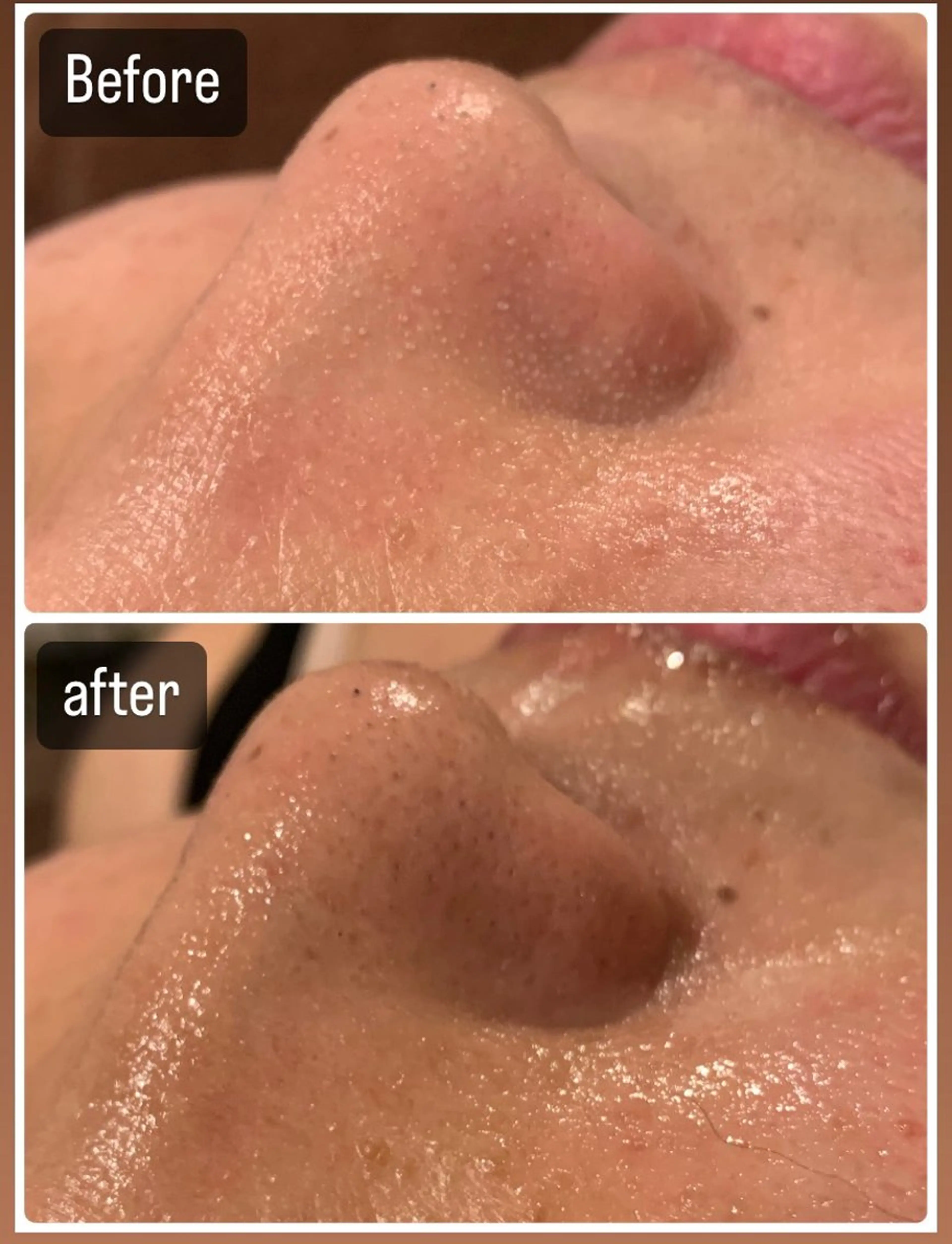 ジェルパック＋毛穴集中ケア＋ぷるぷる生パック＋ビタミンC導入🍋✨の写真