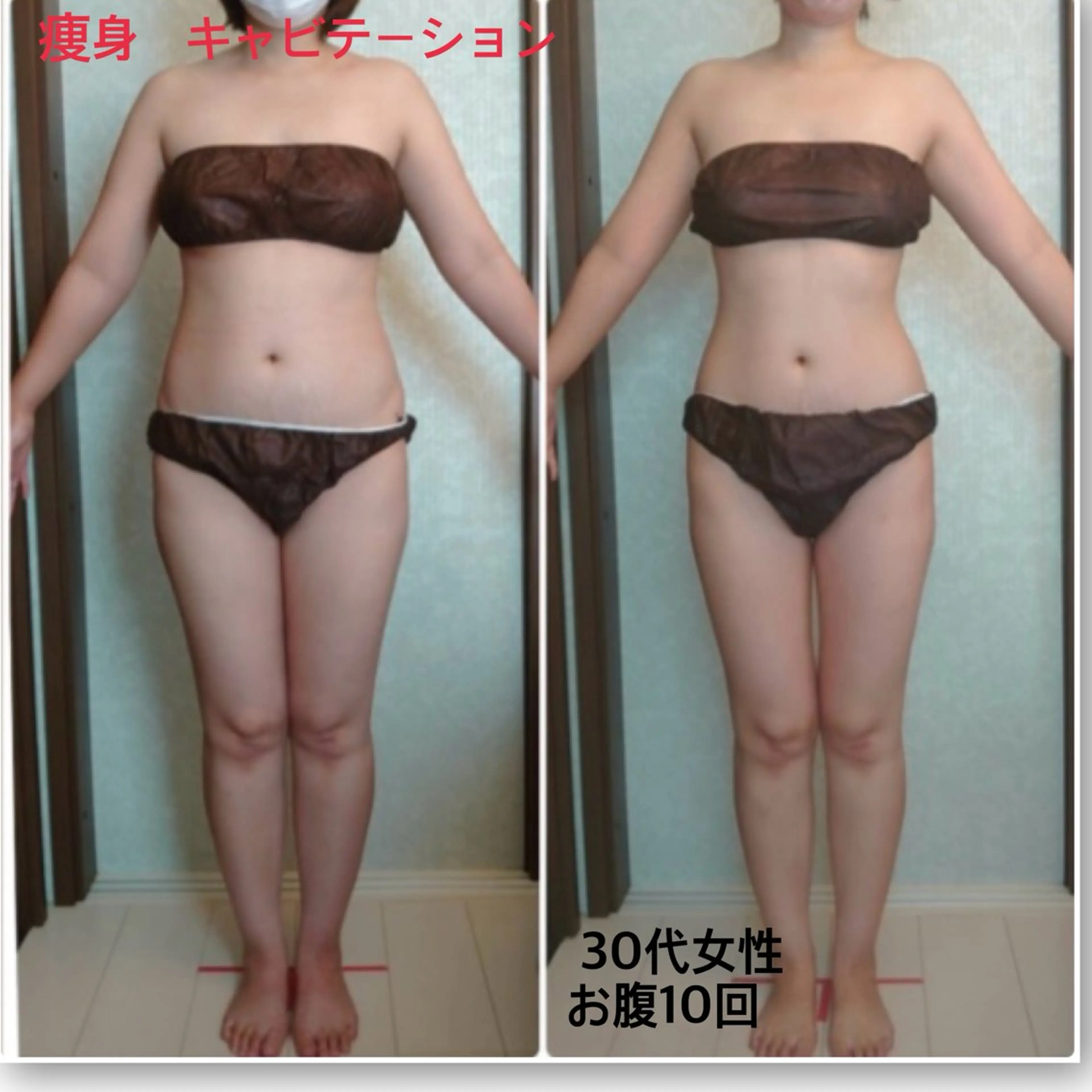 痩身60分10回コース😊99,000円✨1回あたり99,00円🔥48,000円お得🉐　その都度払いOK!の写真