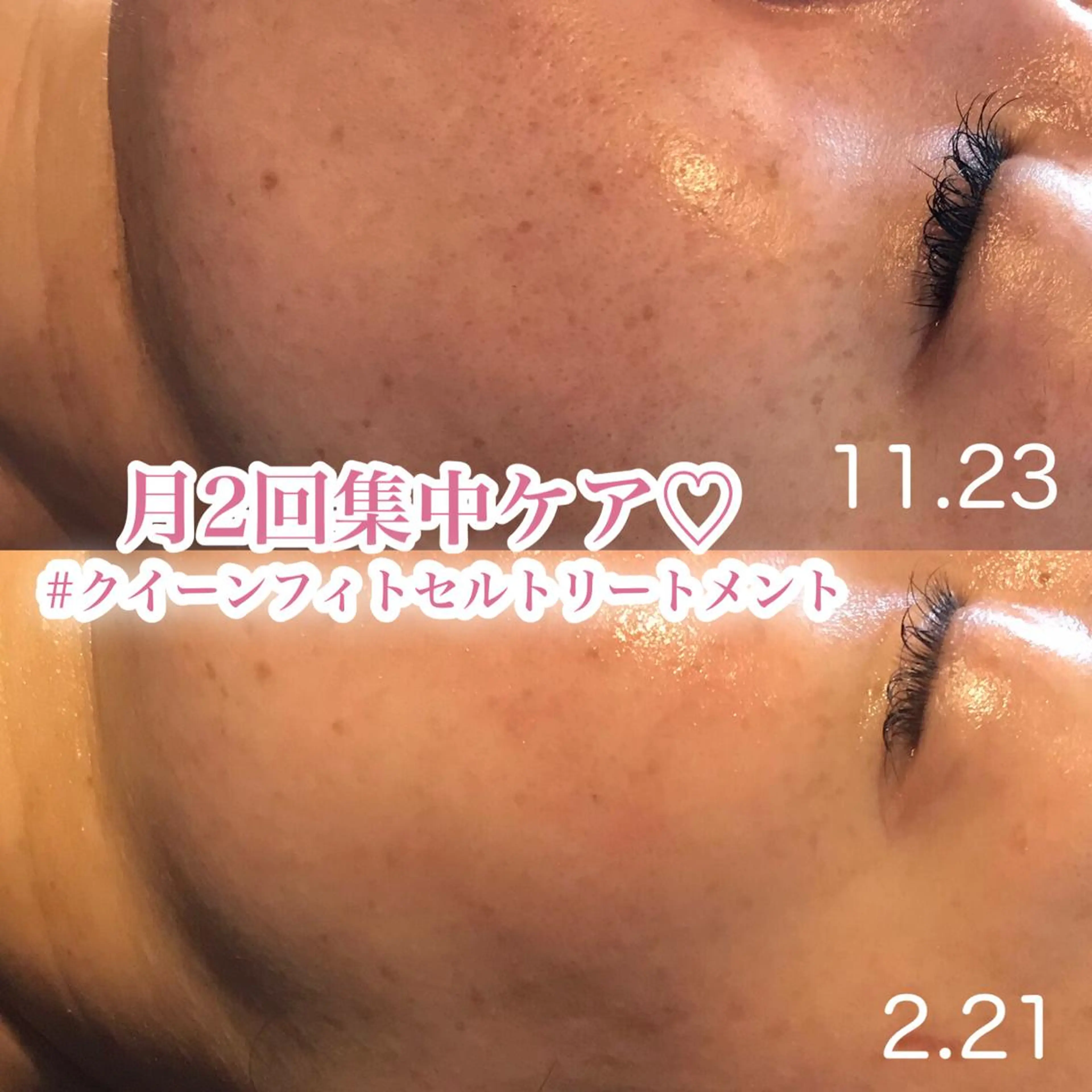 エステ 浜野 恵美のエステ・リラクイメージ