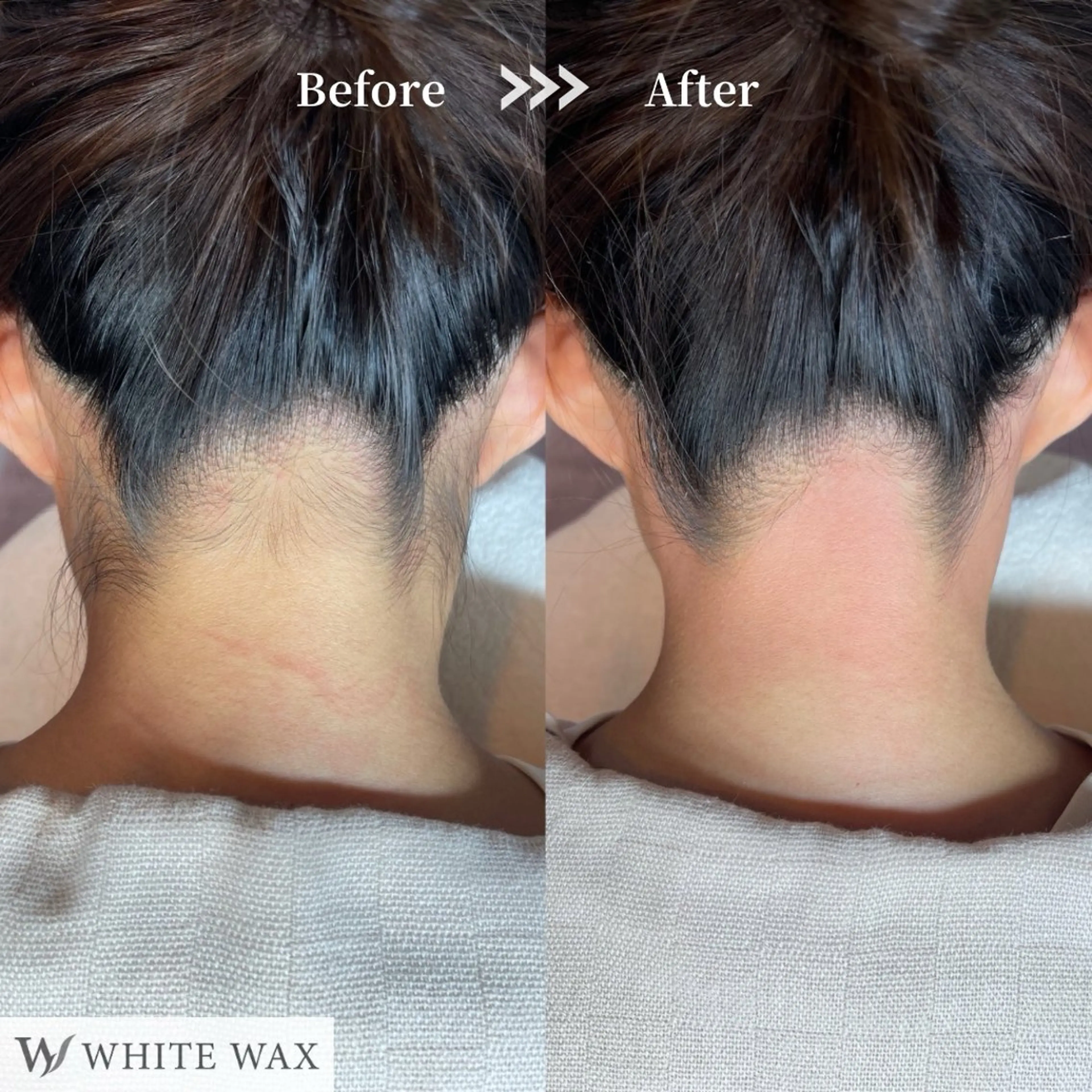 【自然に仕上げる】両うなじ＋首後ろの写真