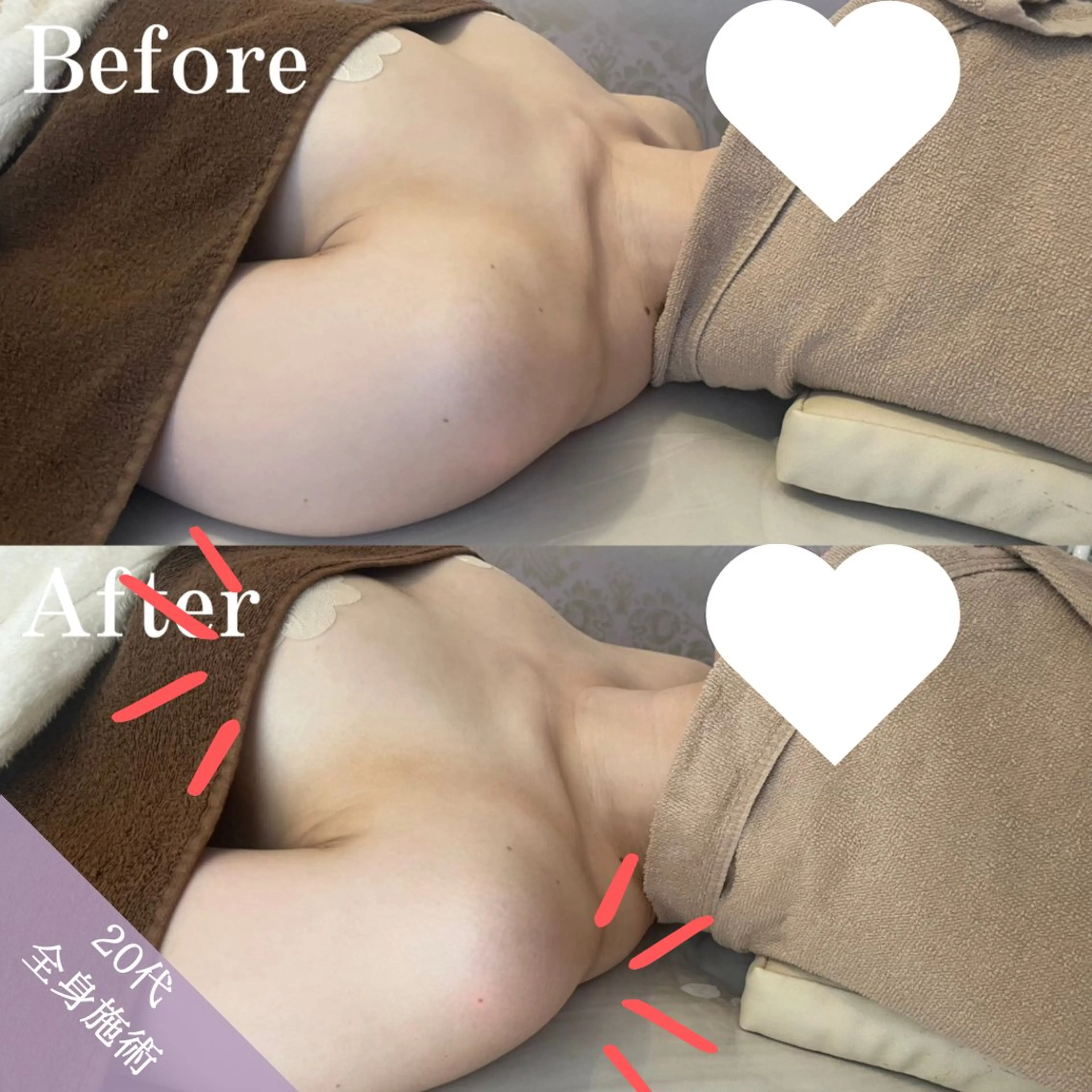 【先着2名様のみ！】半額で3回施術を受けれる"全身"バストモニター様♪の写真