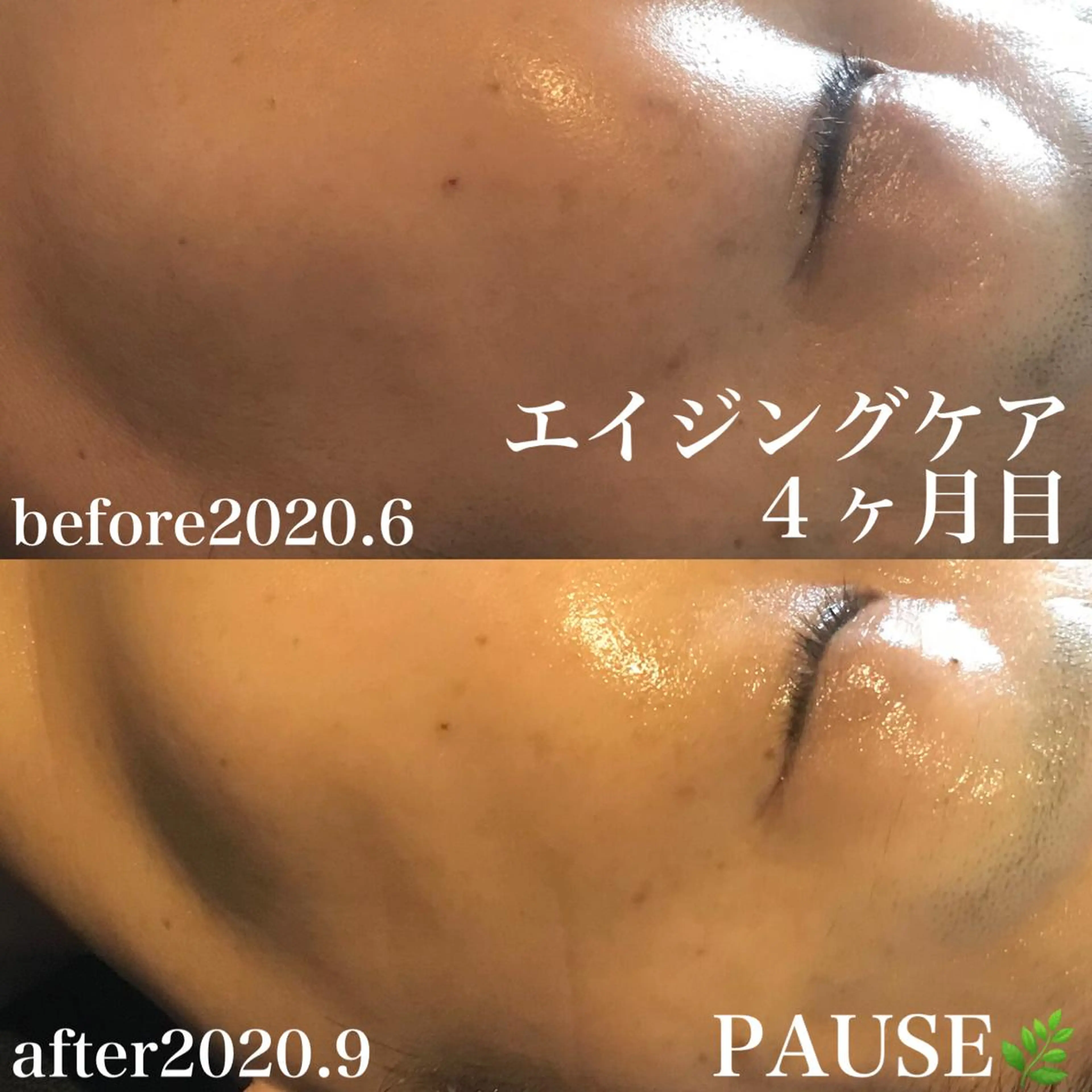 エステ 浜野 恵美のエステ・リラクイメージ