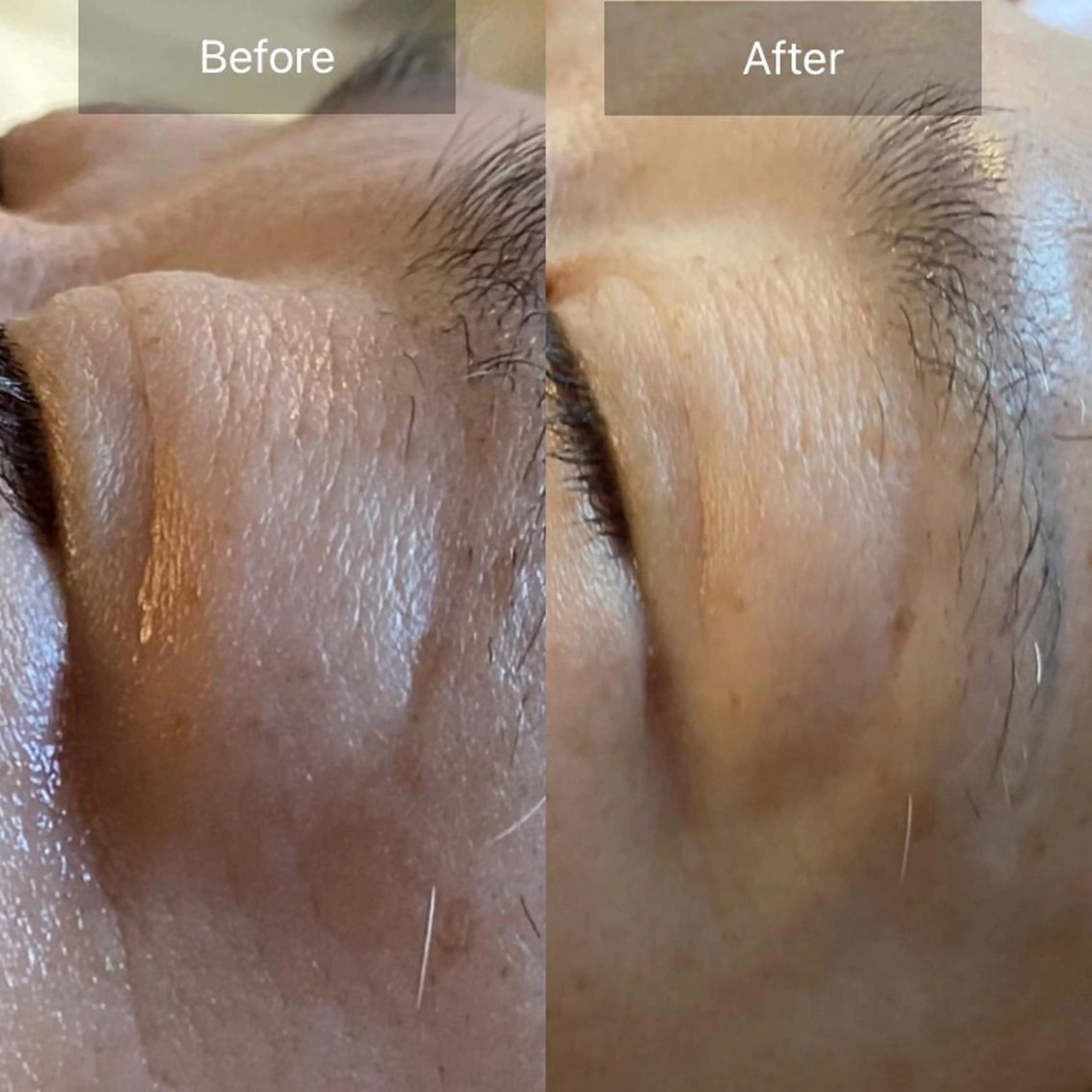 エステ リラク Mandarin Orange所属・毛穴から始める肌メン テマンダリンオレンジのエステ・リラクイメージ