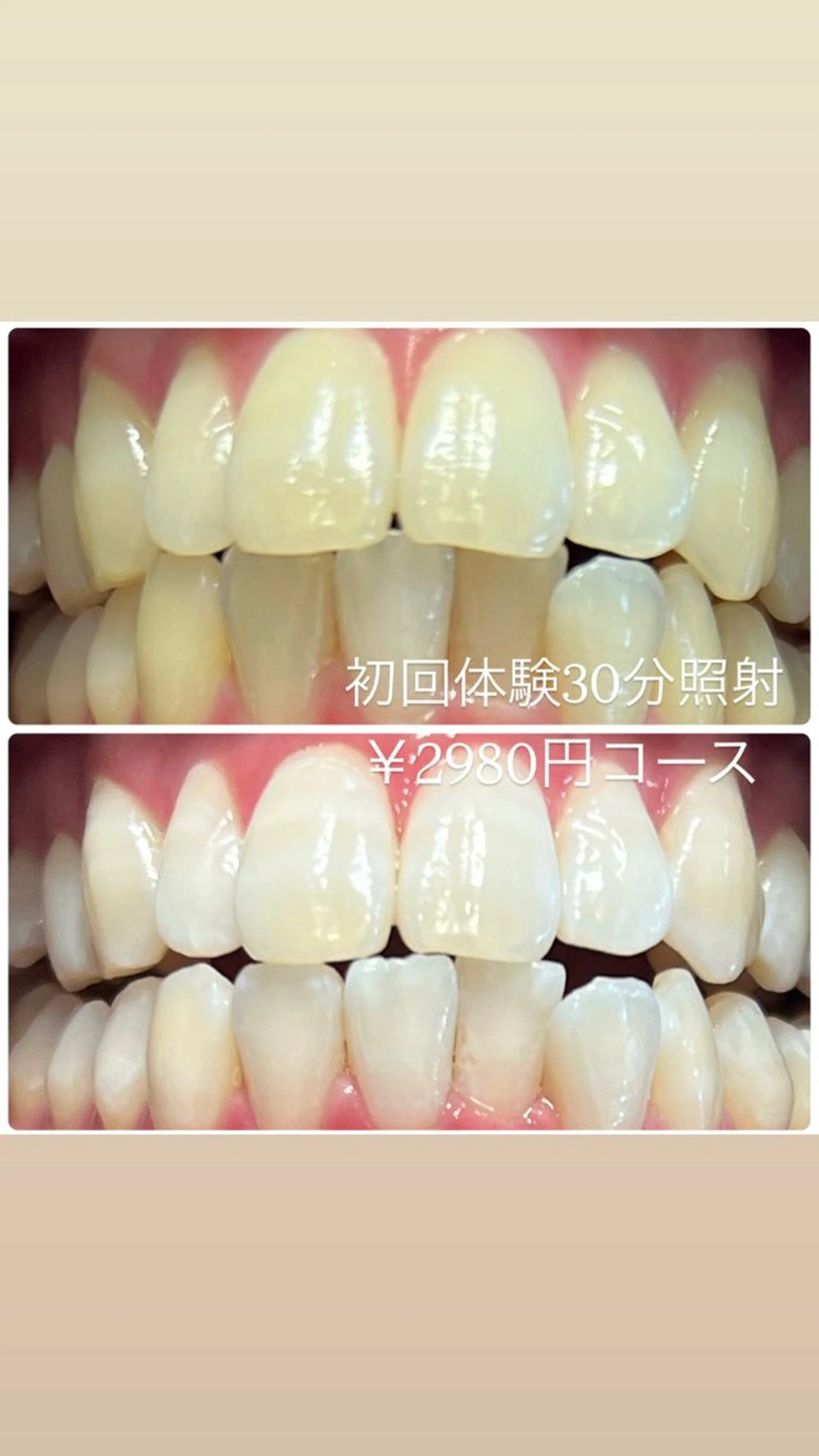 その他 PLATINUM Beauty 横浜店所属・ホワイトニングルーム 横浜店のその他イメージ