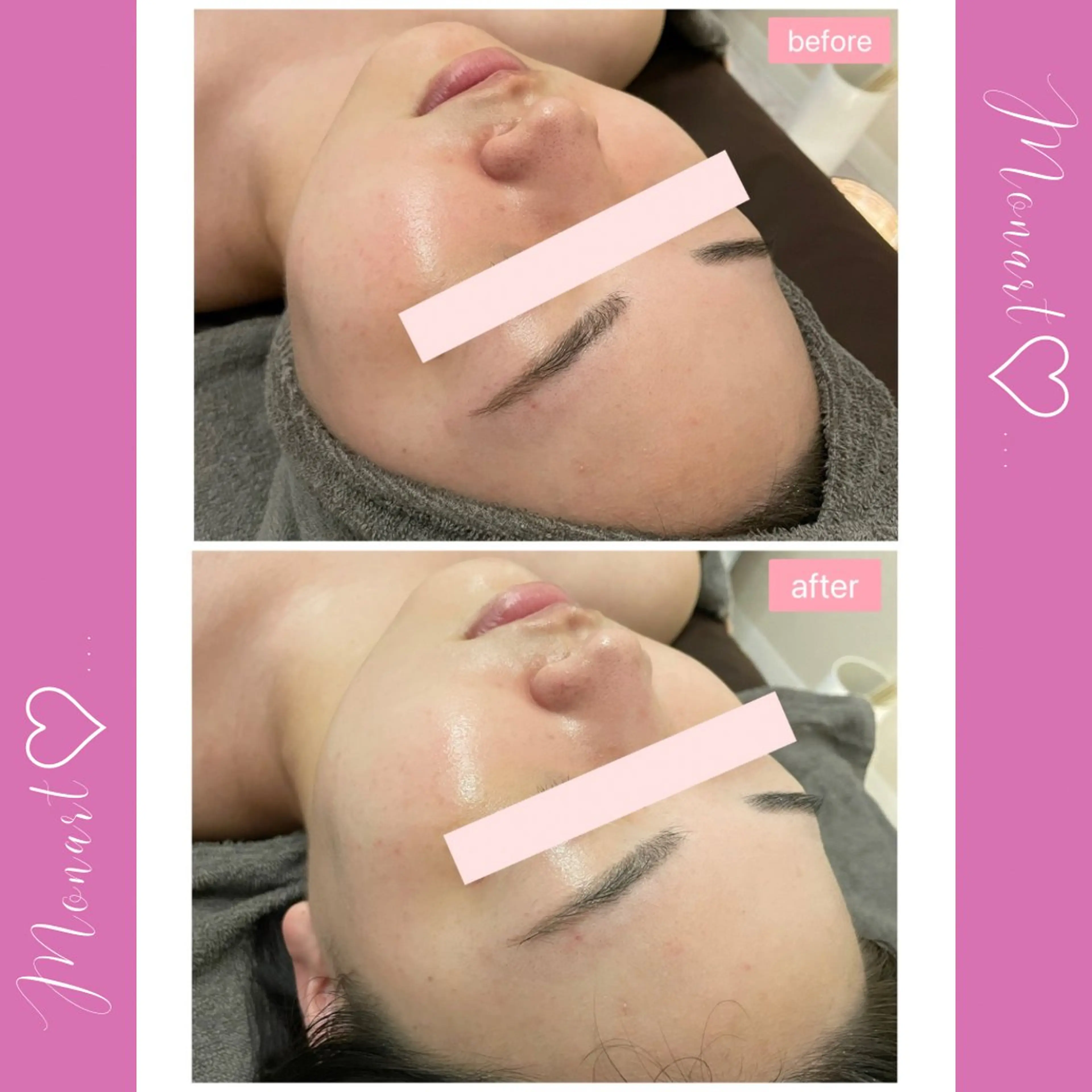 Monart -deux-のエステ・リラクイメージ