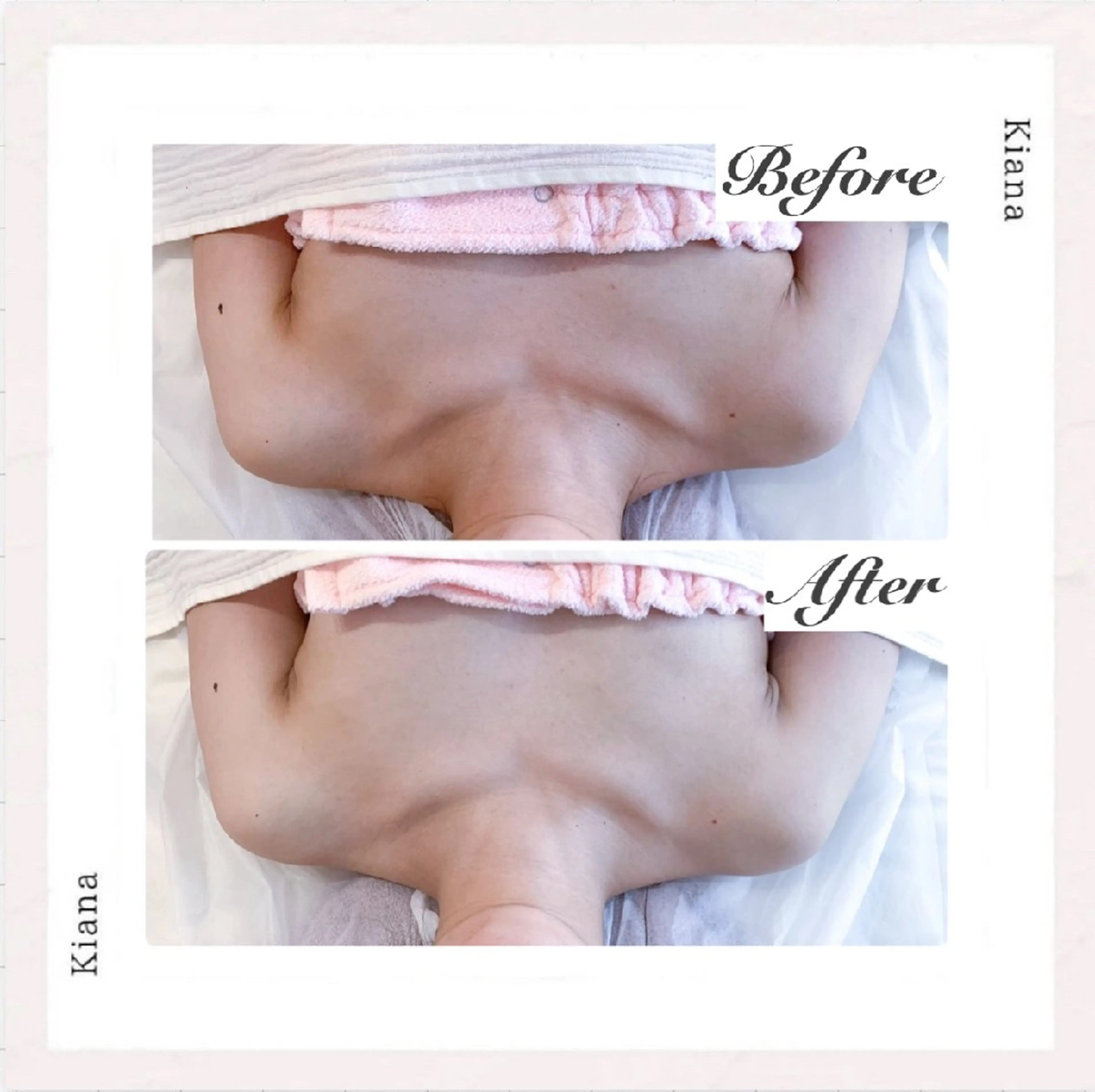 エステ リラク 【バスト専門店 】 Kiana のエステ・リラクイメージ