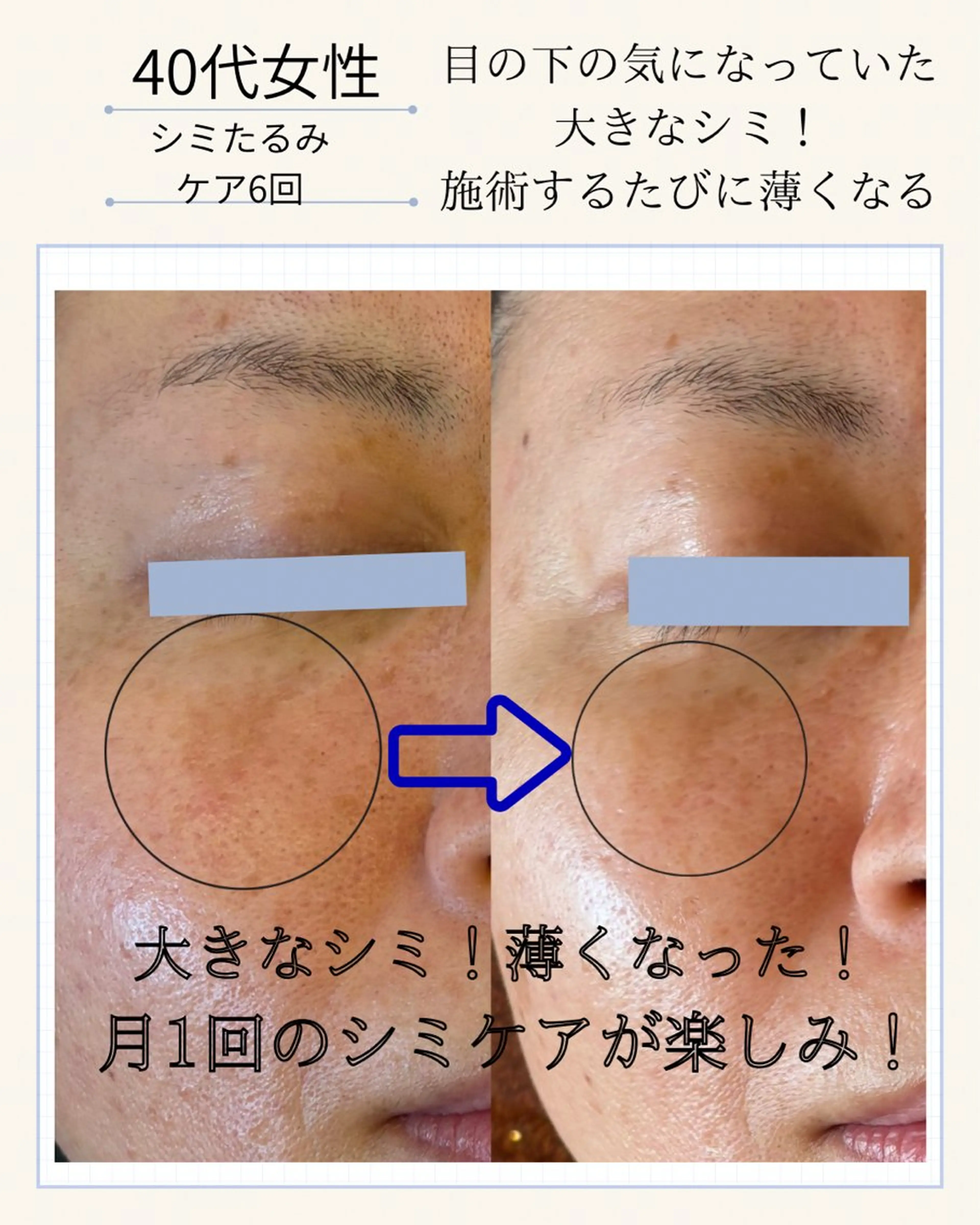 エステ エステサロン グラマラスのエステ・リラクイメージ