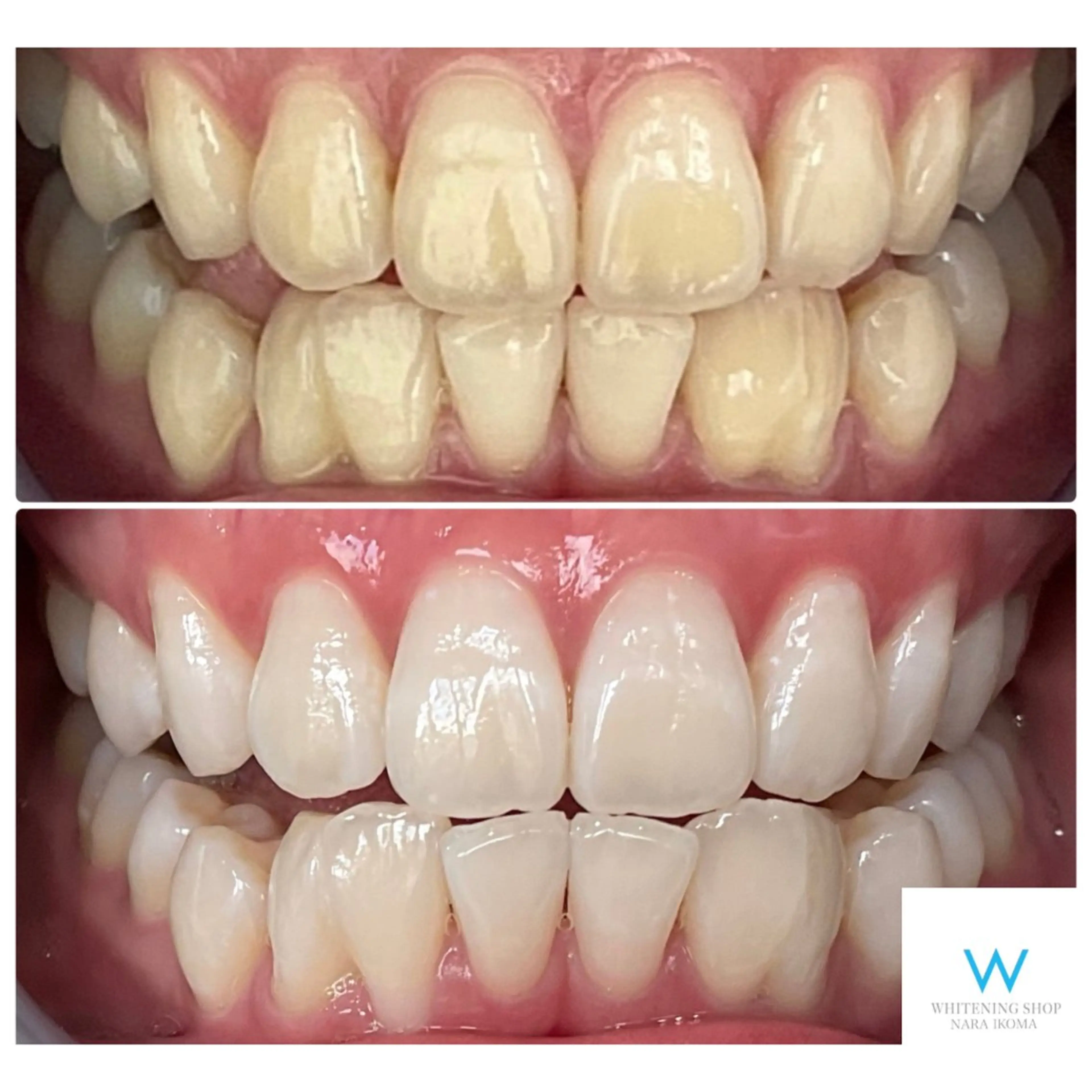 エステ リラク ホワイトニングショップ奈良生駒店所属・乾 理望のエステ・リラクイメージ