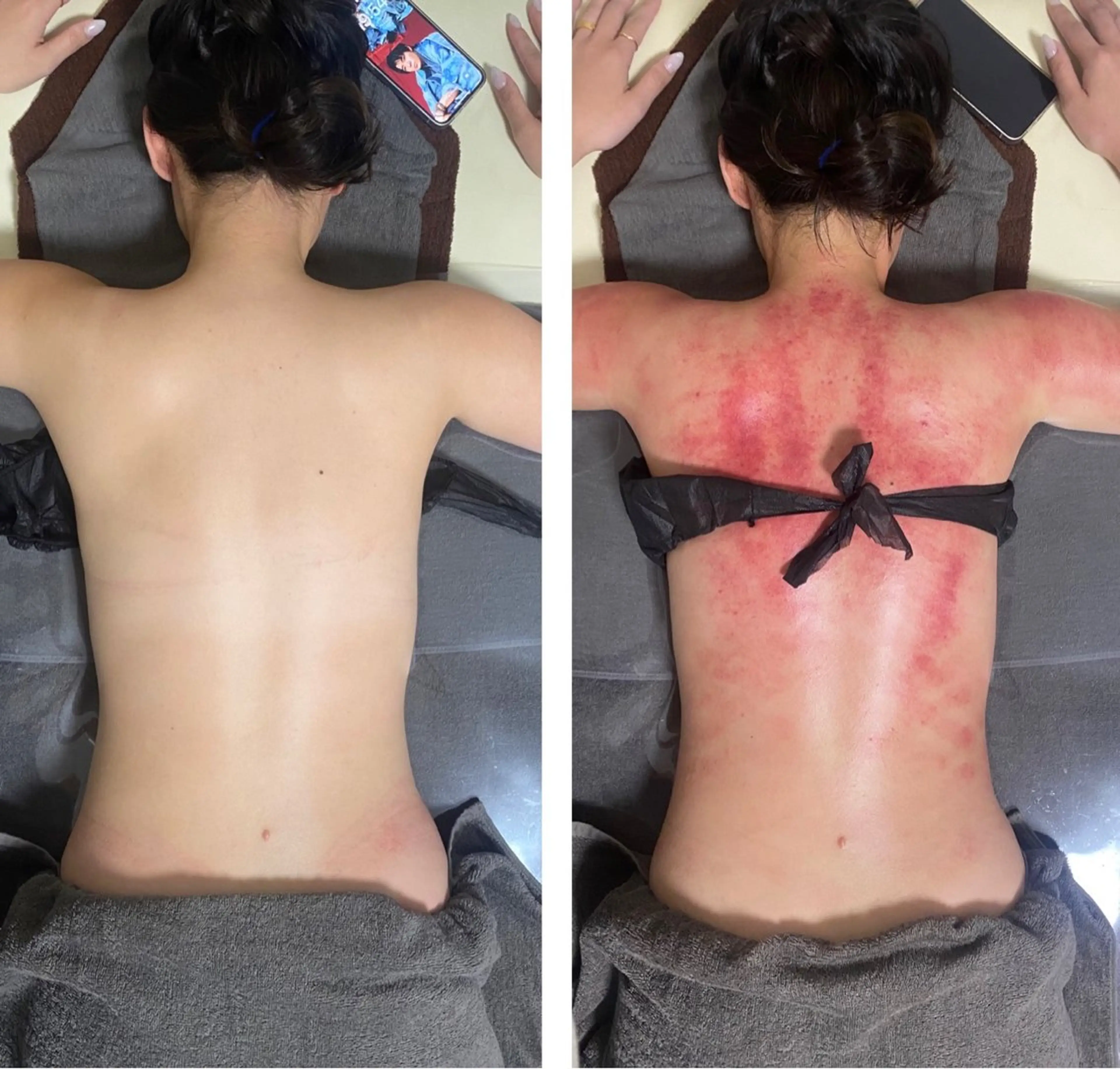 セルライトクラッシュ 腸もみ　bi♡eruのその他イメージ