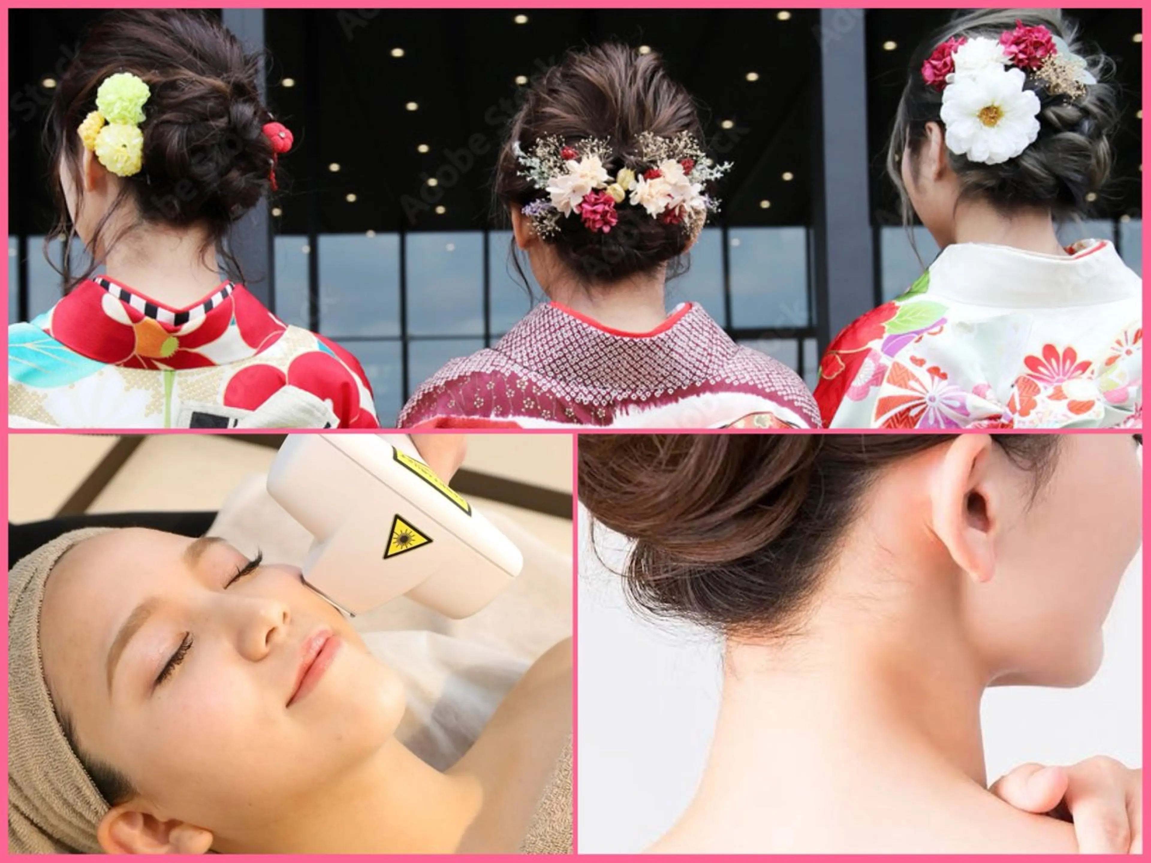 ◎12月限定【成人式】顔脱毛＋うなじ脱毛（シェービング付き）¥13860→¥5980の写真