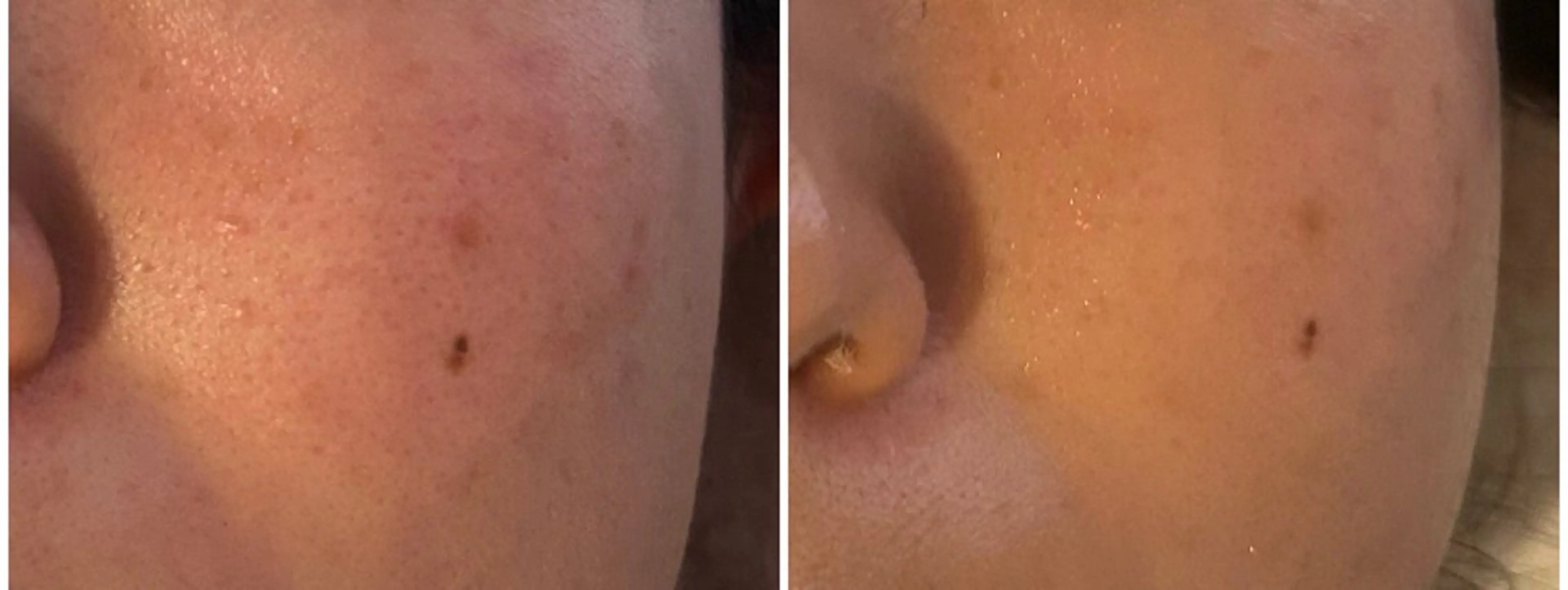 デアイム川口前川所属・エイジング肌質改善 サロンプレジールのエステ・リラクイメージ