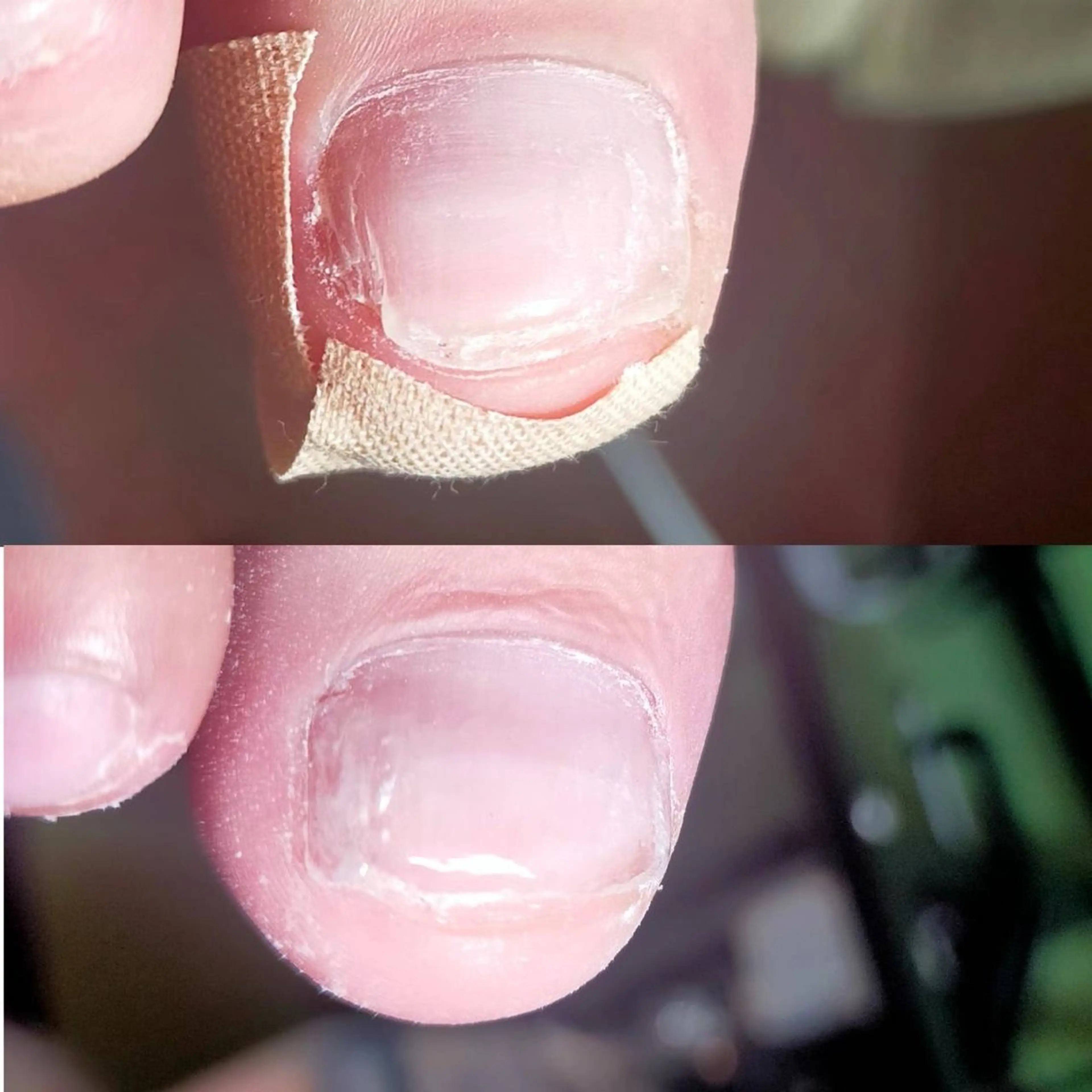 ネイル その他(ネイル) Cure.美爪育成 salon 岡澤のネイルデザイン