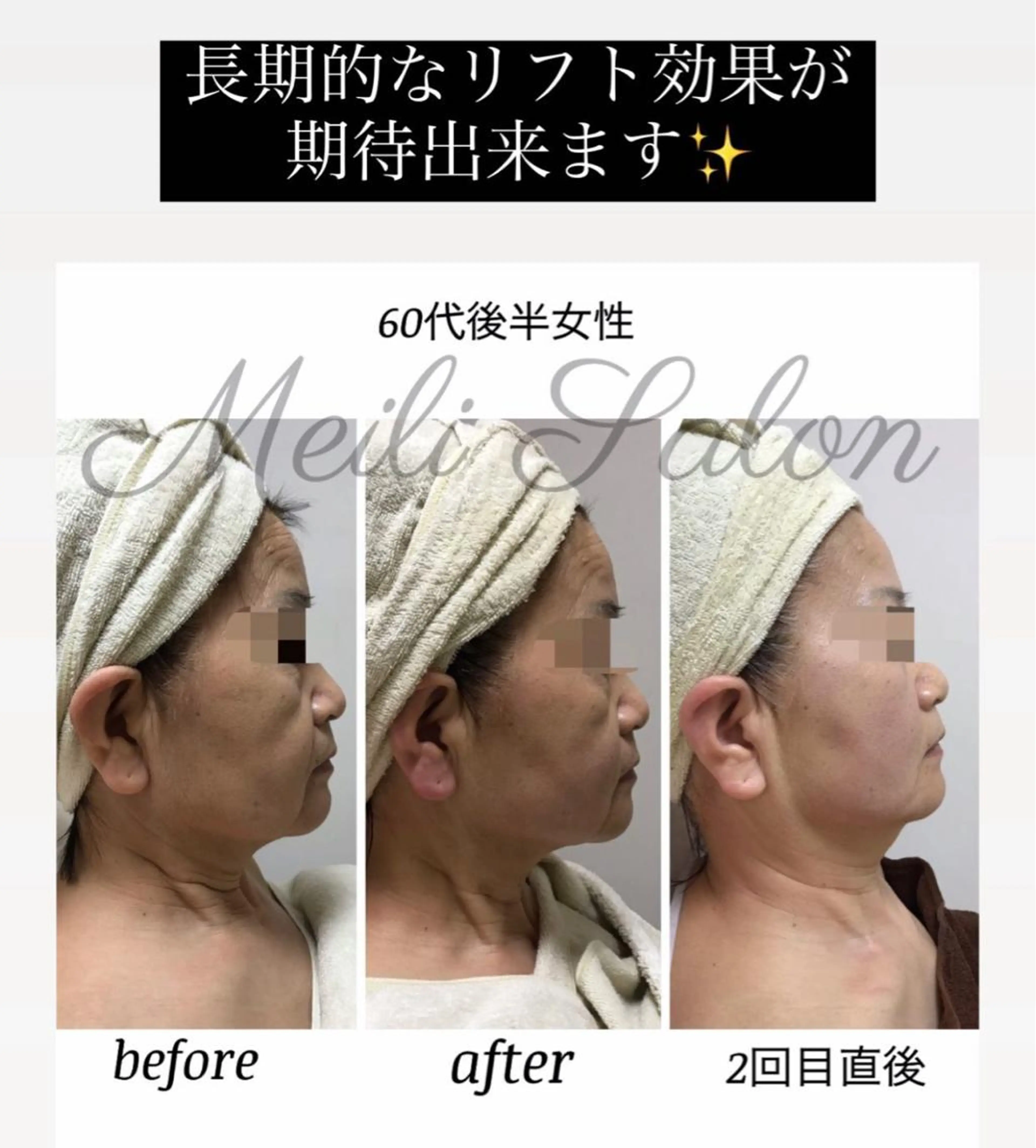 Private  Beauty Salon " MEILI"所属・meili salonのエステ・リラクイメージ