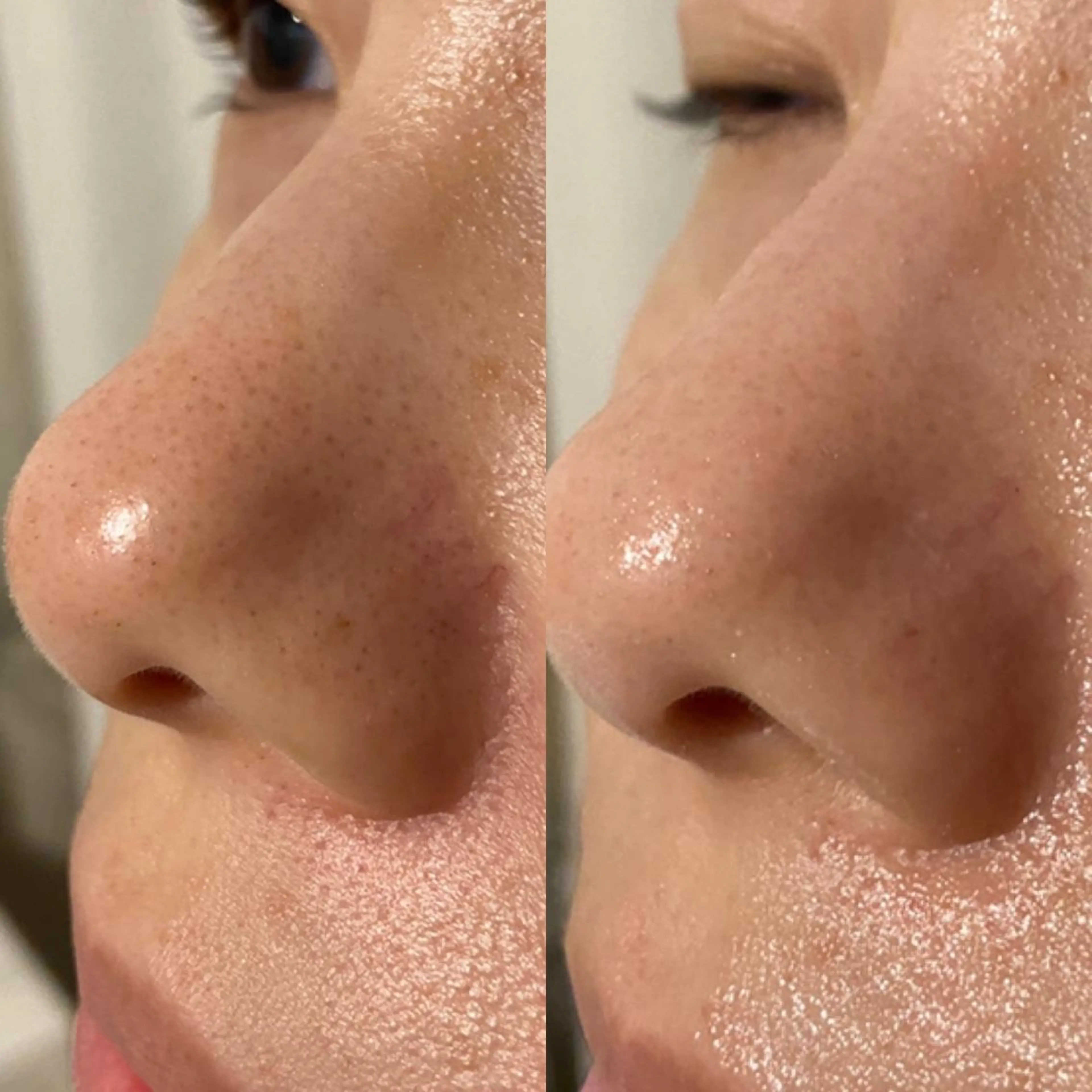 よもぎ蒸し専門店Artemisia所属・よもぎ蒸し専門店 Artemisiaのエステ・リラクイメージ