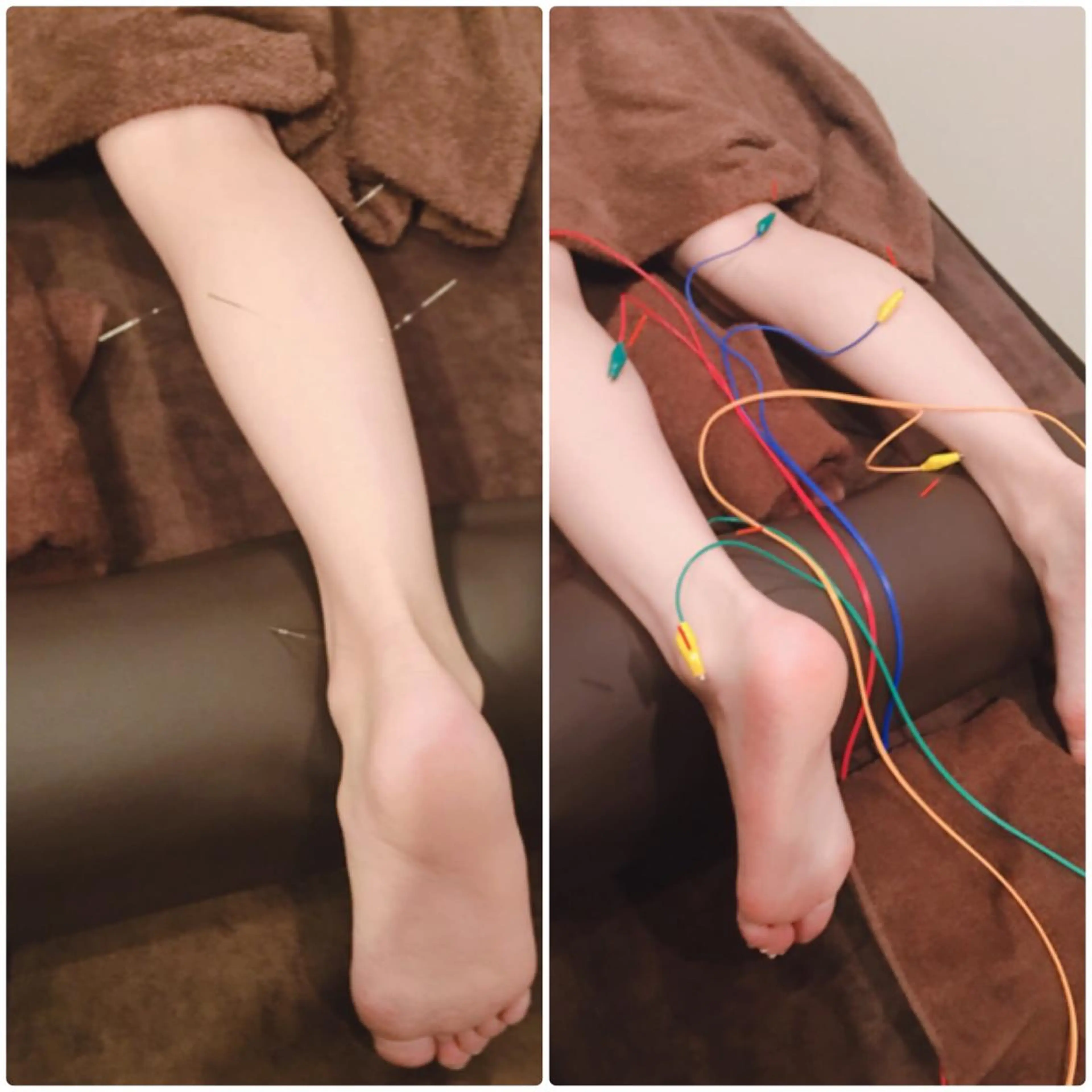 表参道鍼灸院K 美容鍼🔮ララピールのエステ・リラクイメージ