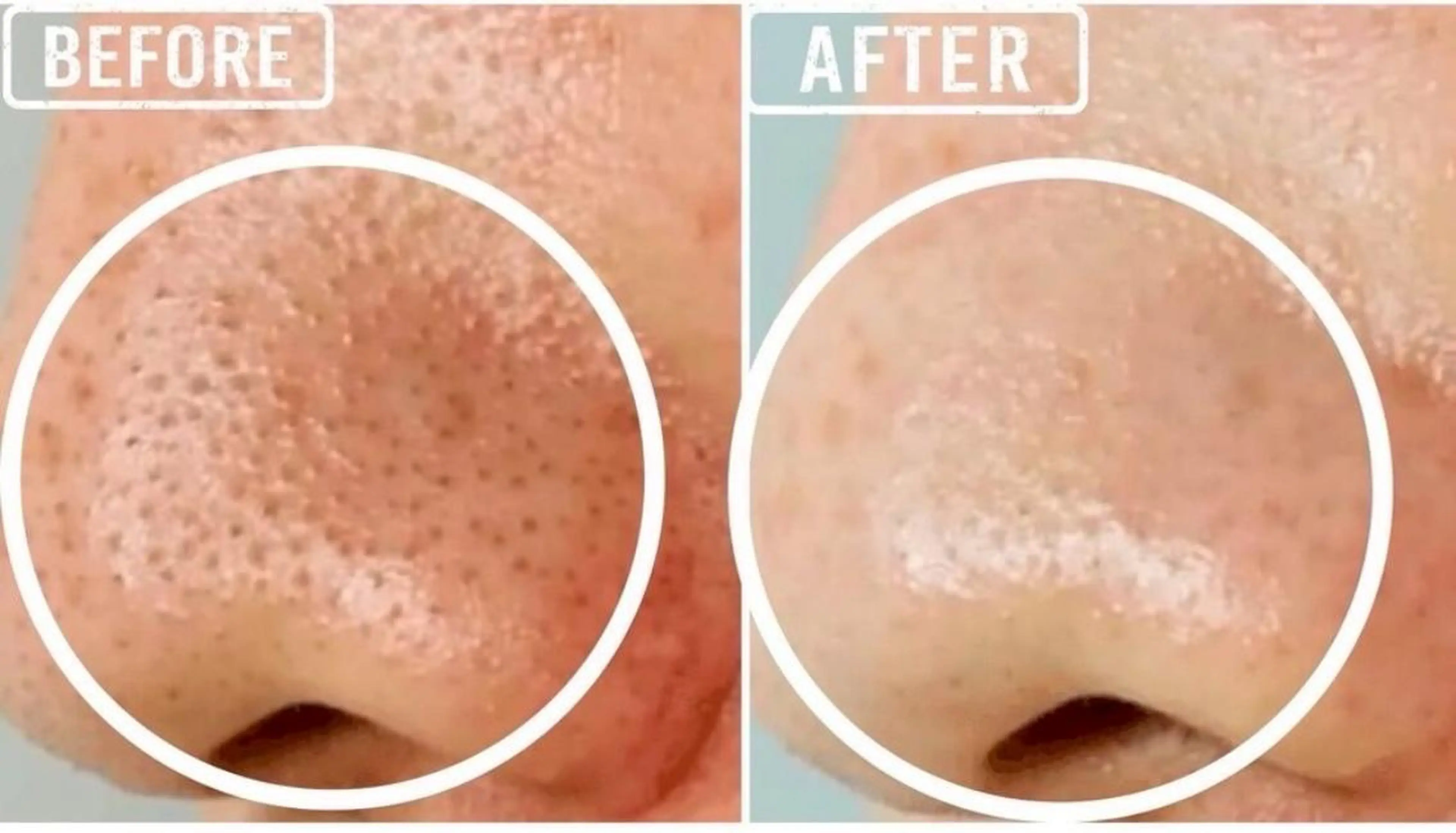 エステ 毛穴/毛穴洗浄専門 エミルカ船橋のエステ・リラクイメージ