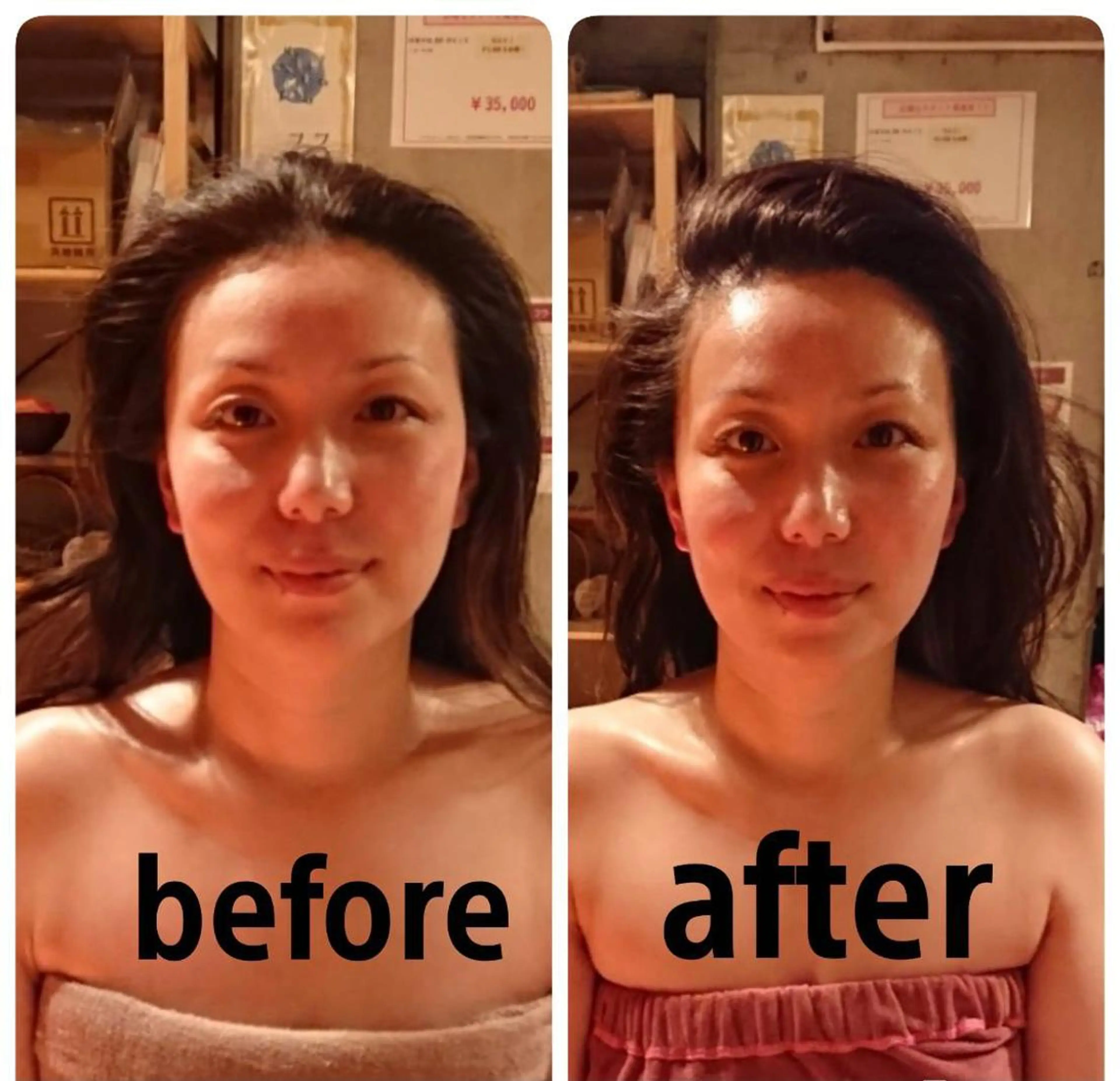 🪷背中＆デコルテ付🪷コルギ70分＆Ge黄土よもぎ蒸し40分ダイエットメニュー♡温活にも◎の写真