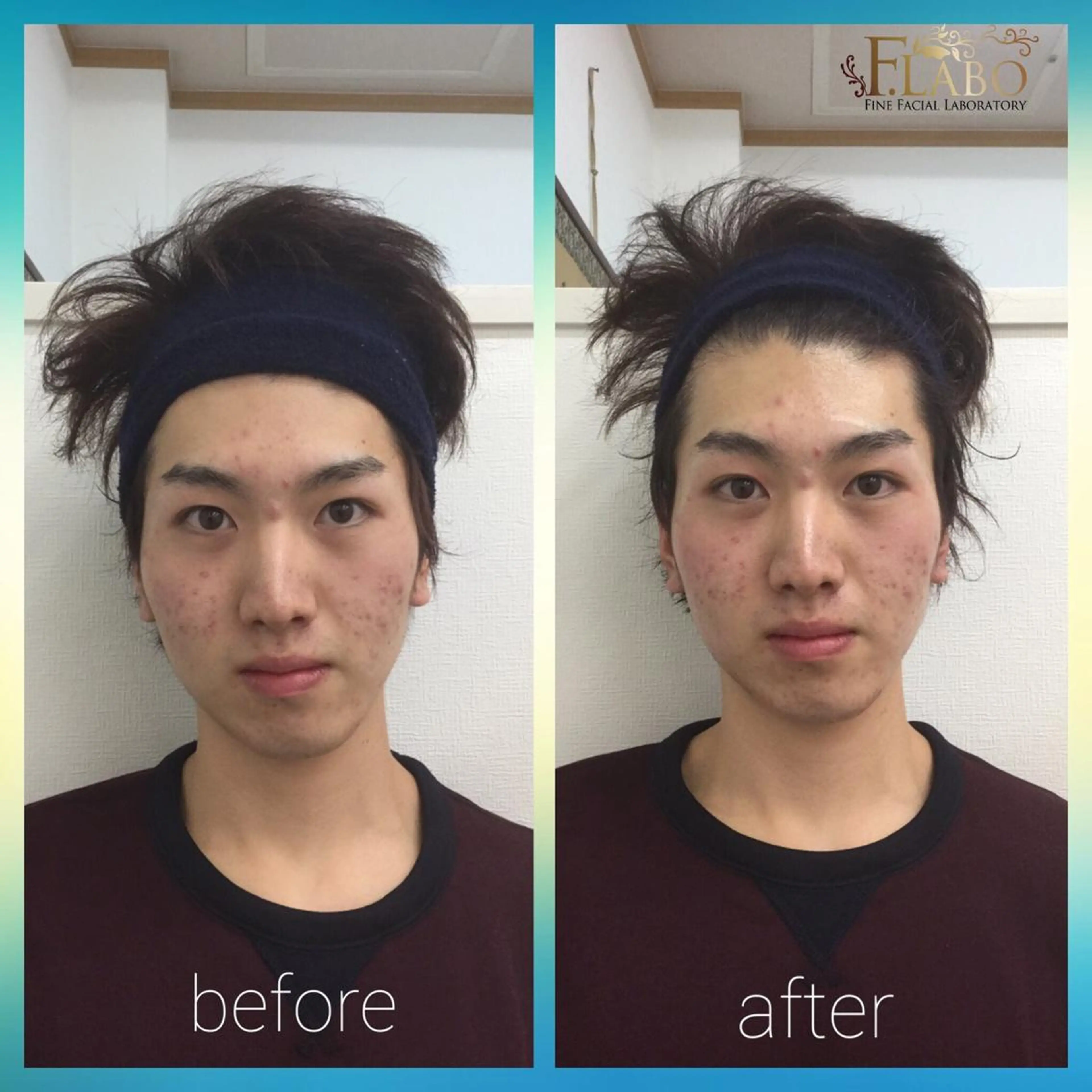 メンズ 小顔&ダイエットジム エステ担当REIKOのその他イメージ