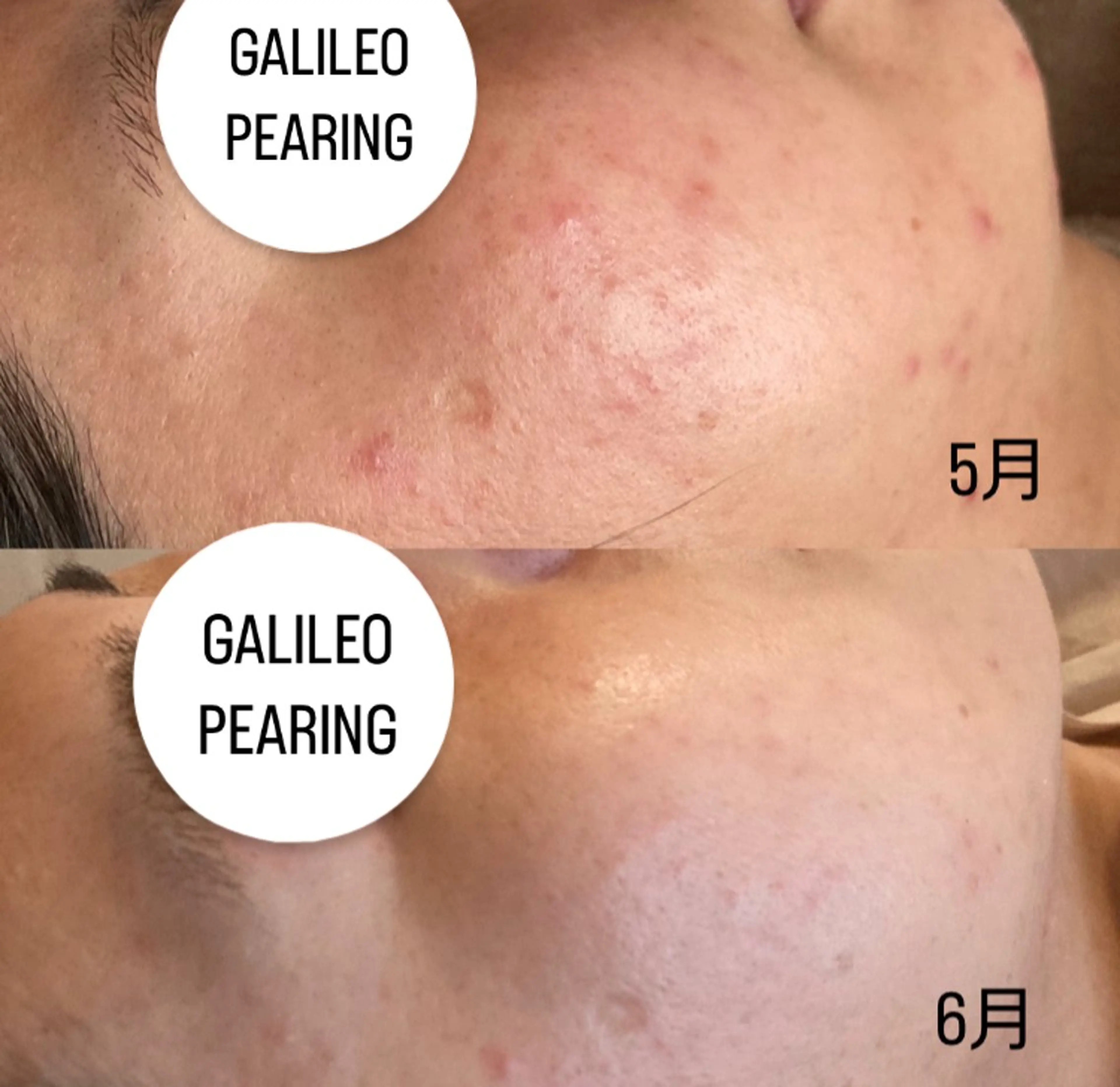 eclair エクレイルのエステ・リラクイメージ