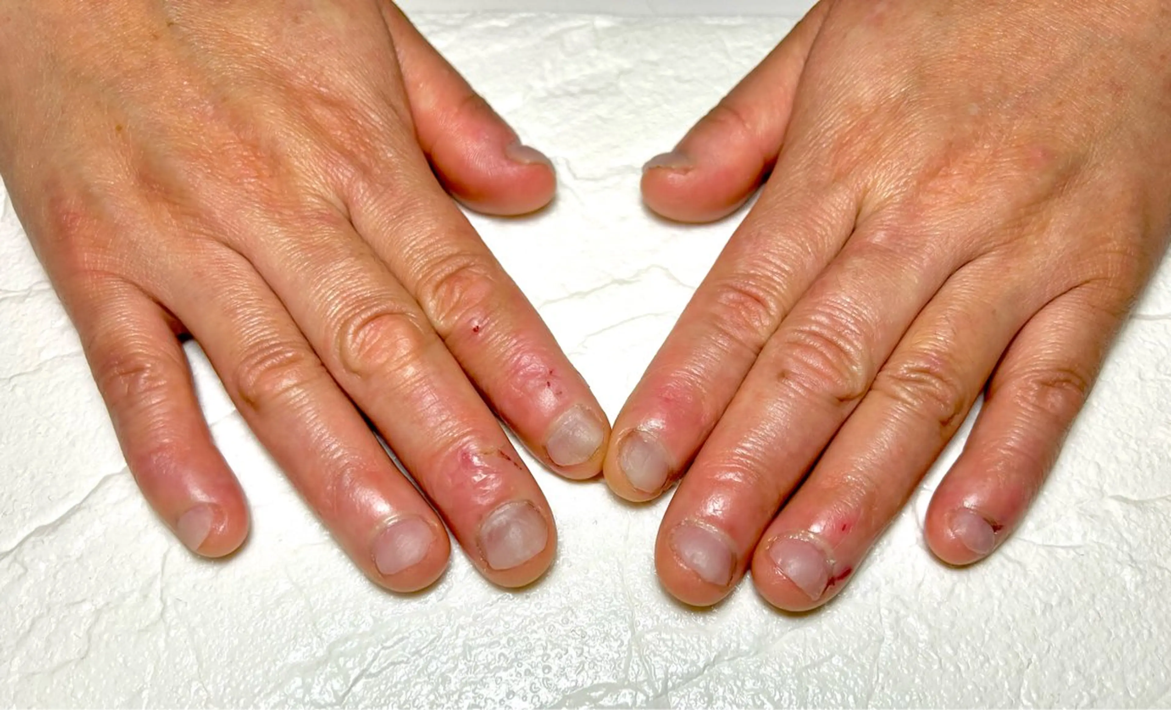 ネイル 深爪・自爪育成専門 MAHALOHIのネイルデザイン