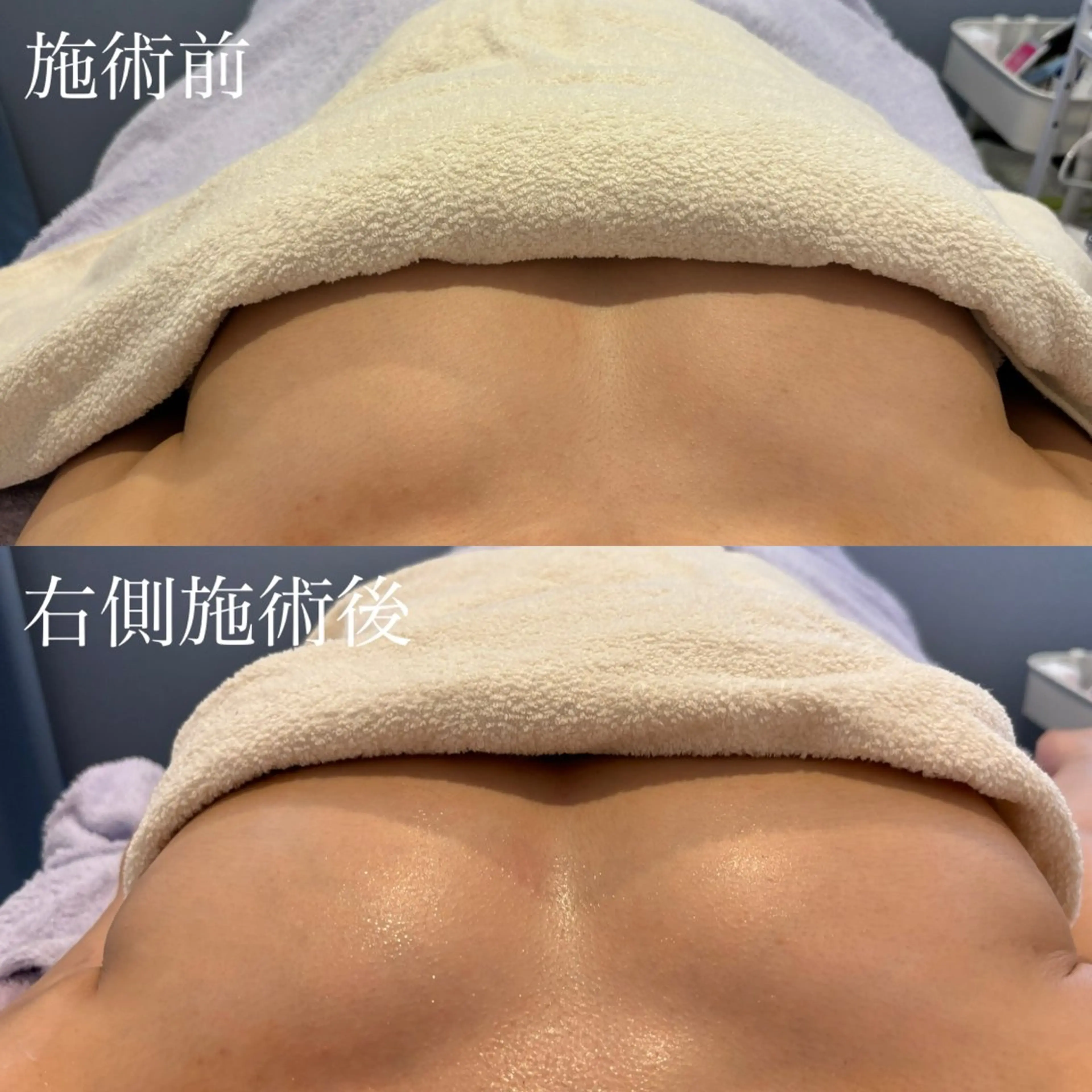 エステ C's Beauté 【シーズボーテ】のエステ・リラクイメージ