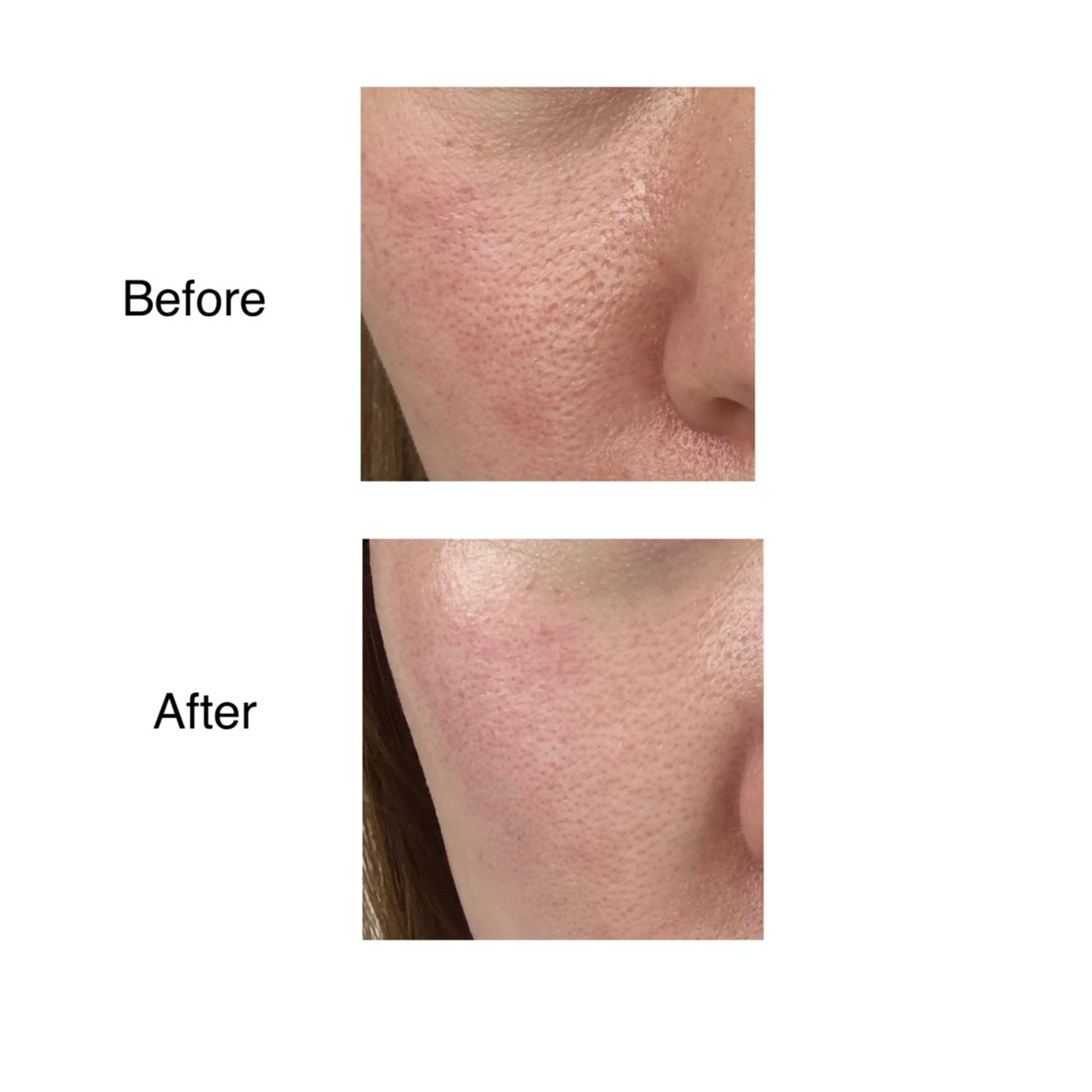 エステ ROR所属・ROR Nanaのネイルデザイン