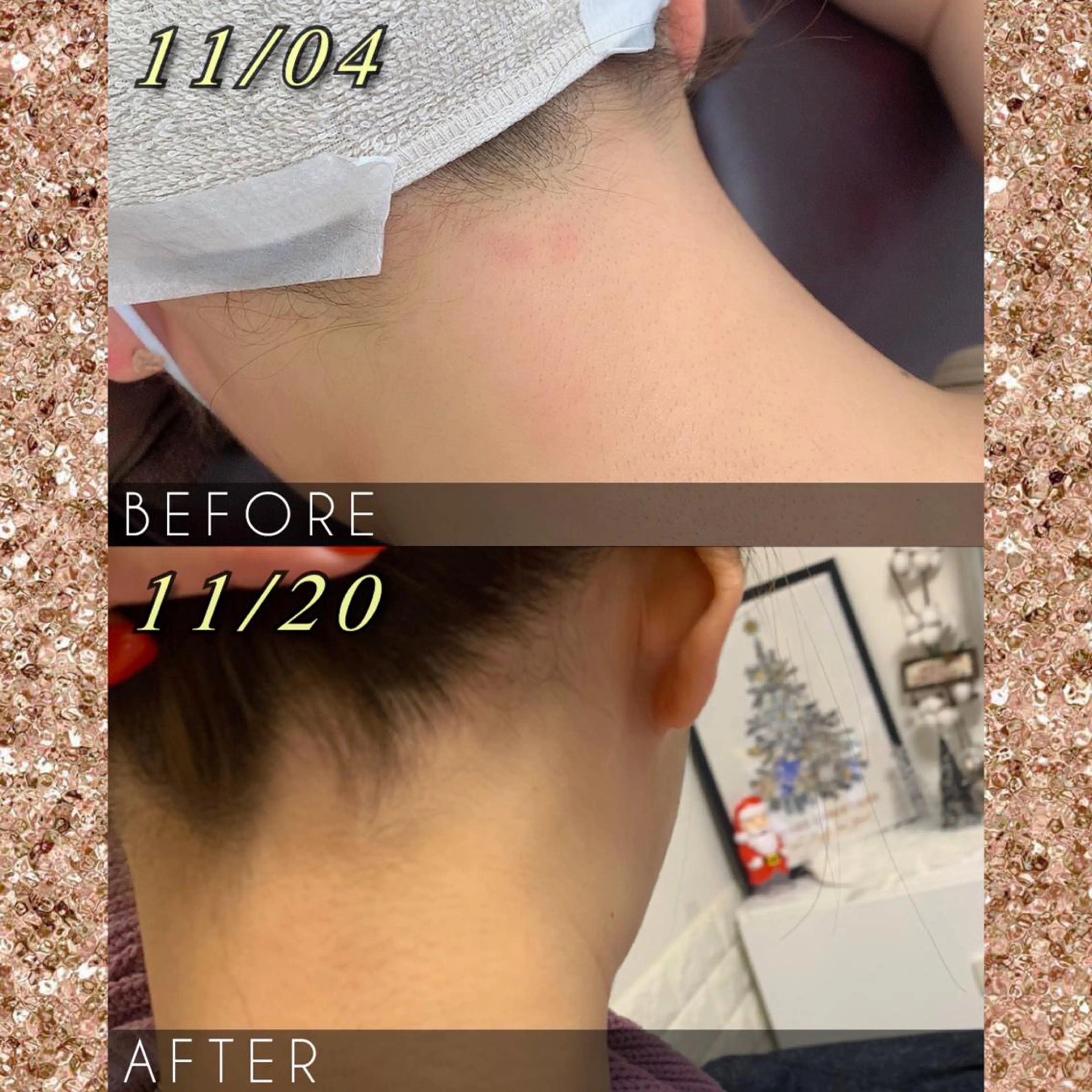 脱毛サロン NR エヌアール所属・NR Nara yukiのエステ・リラクイメージ