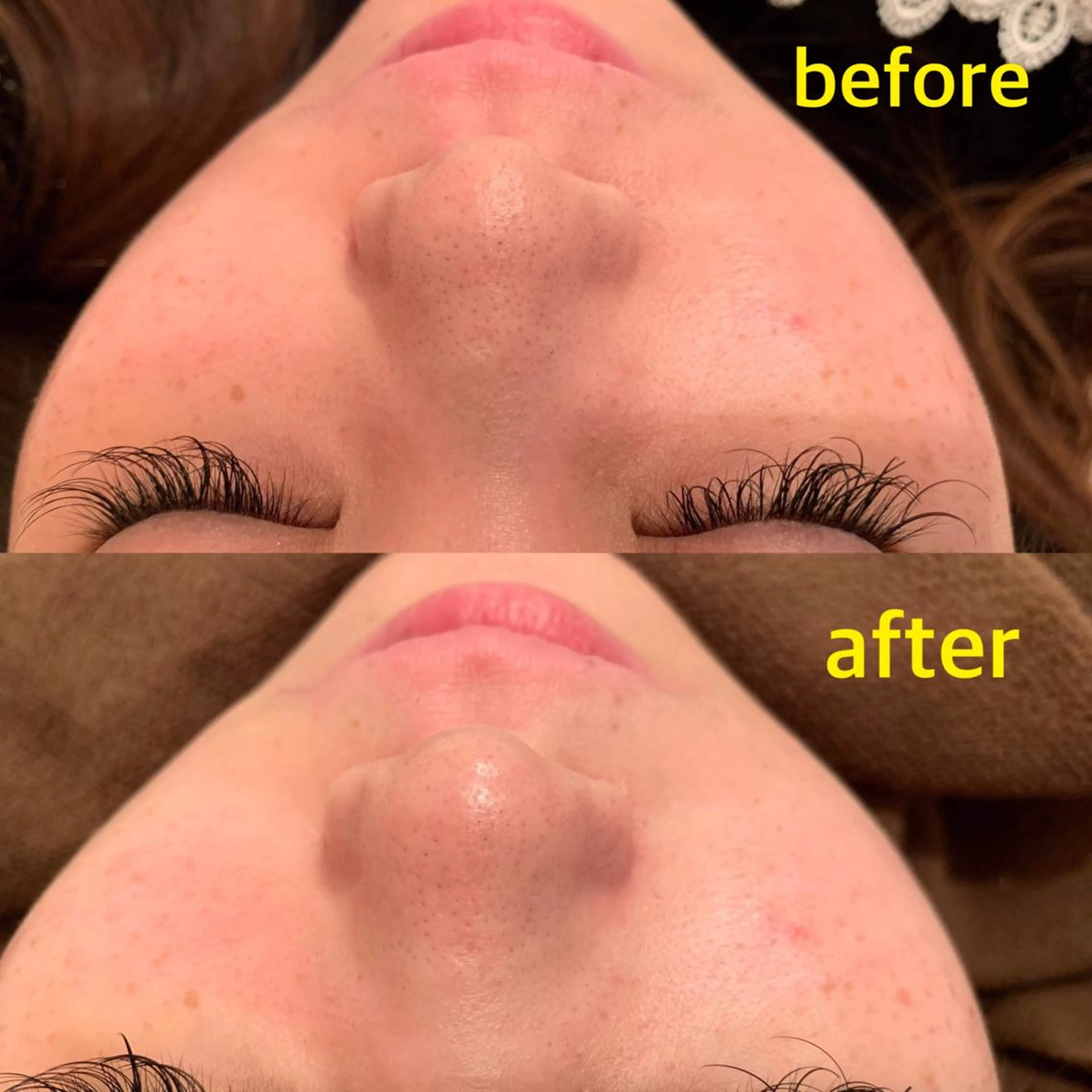 Lila プライベートサロンのエステ・リラクイメージ