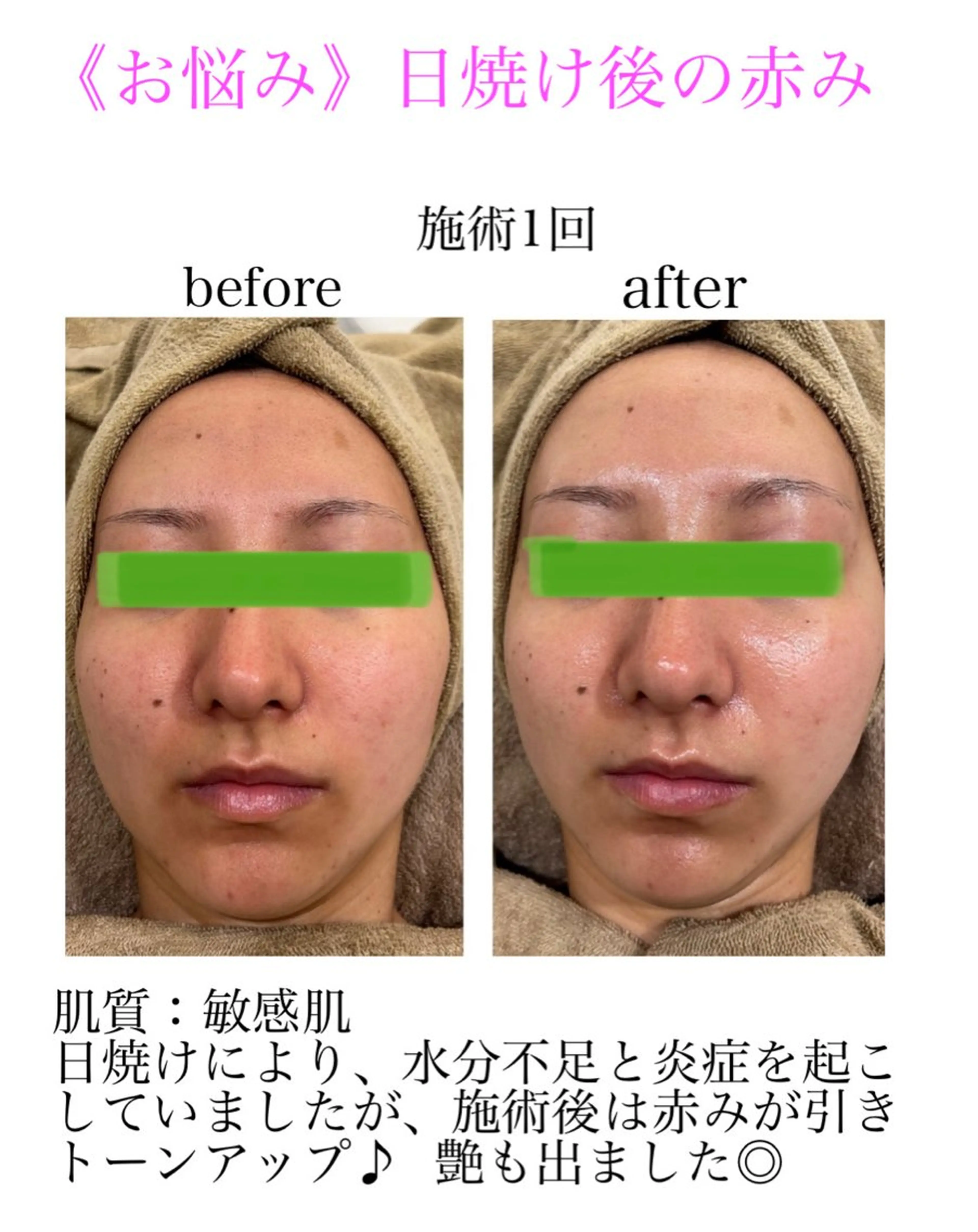 小顔&美肌品川店 Masqueradeのエステ・リラクイメージ