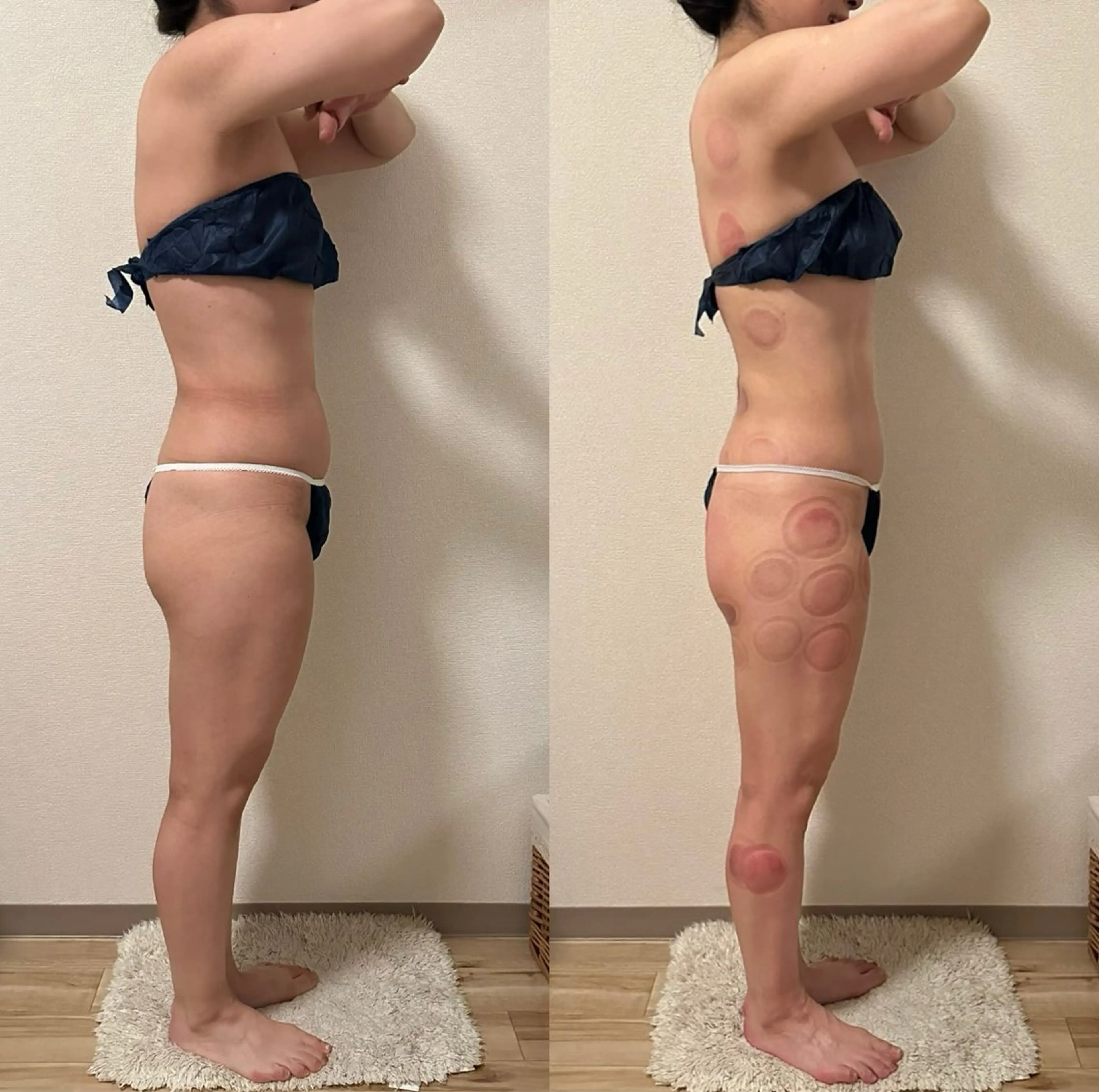 a  room salonのエステ・リラクイメージ