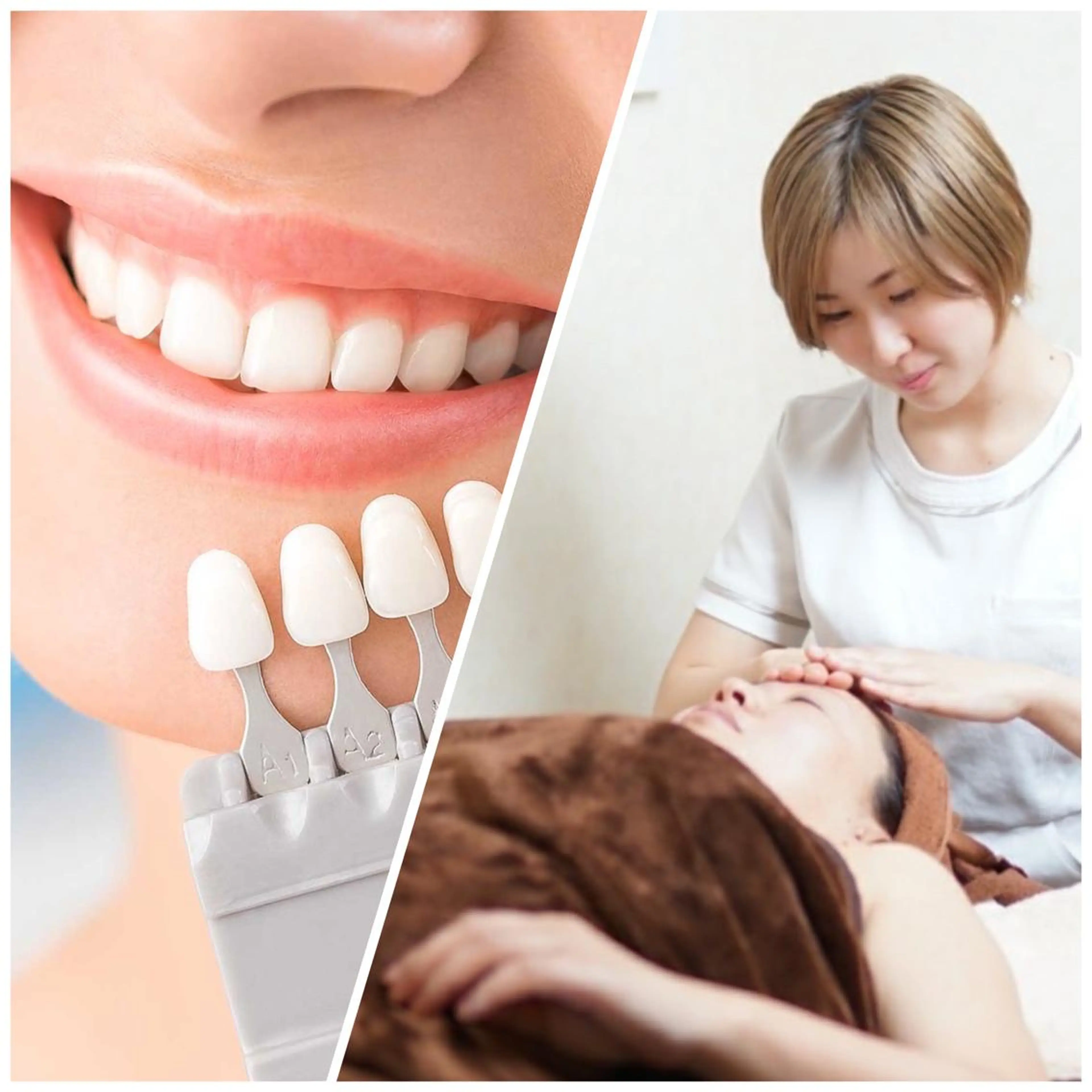 【小顔&白い歯🤍】小顔矯正+セルフホワイトニング(計90分) メンズ可の写真