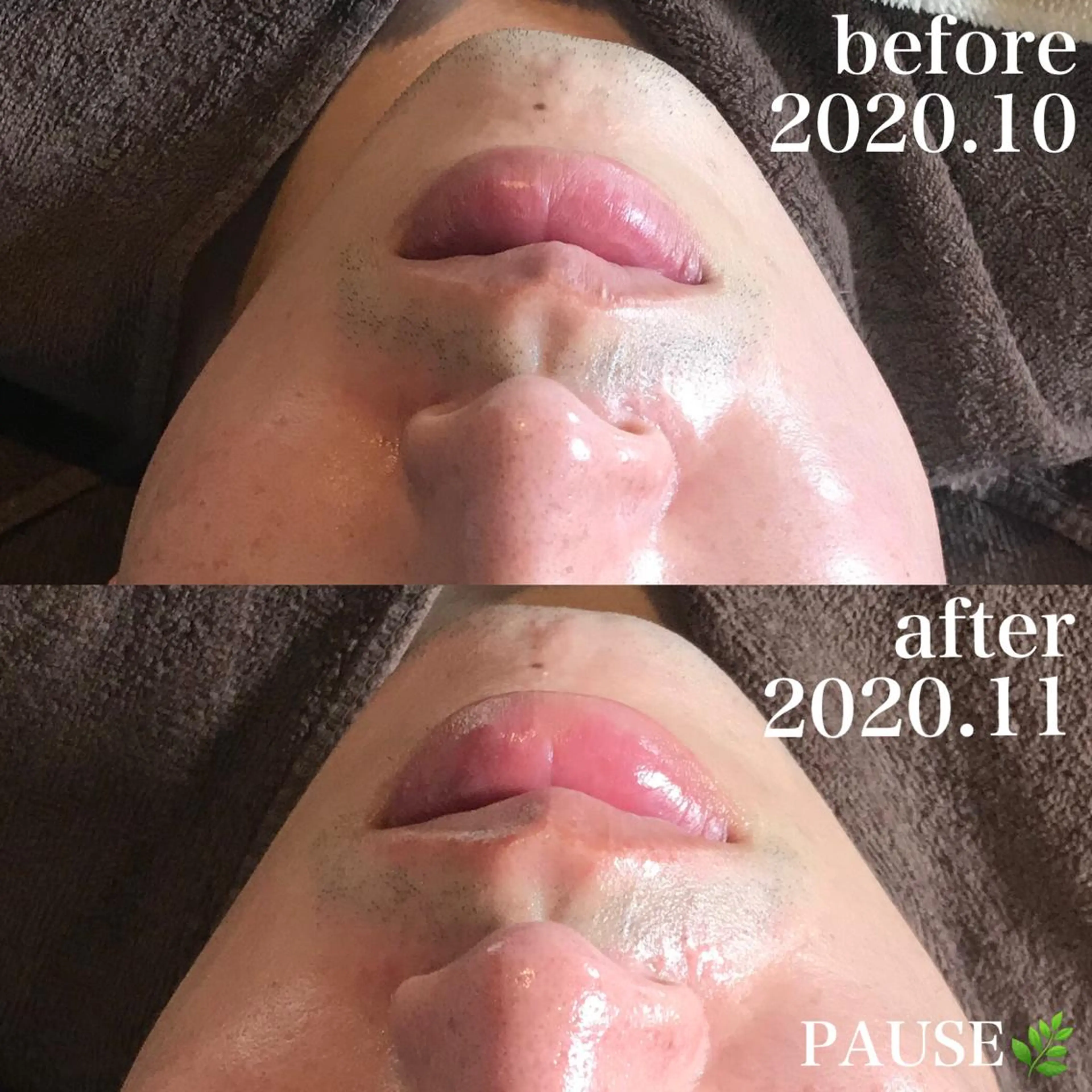 エステ 浜野 恵美のエステ・リラクイメージ