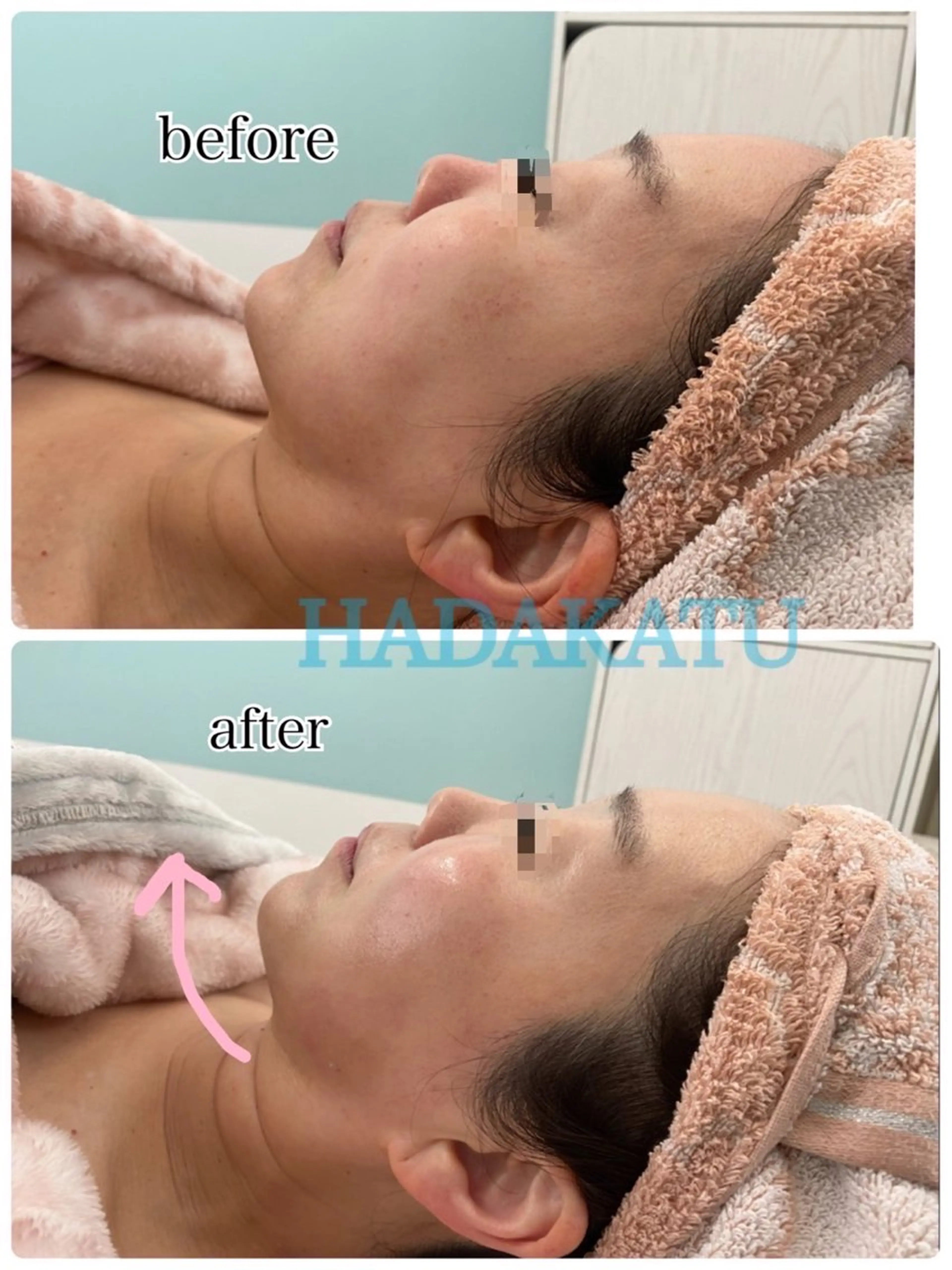 エステ 総合エステサロン 肌活のエステ・リラクイメージ