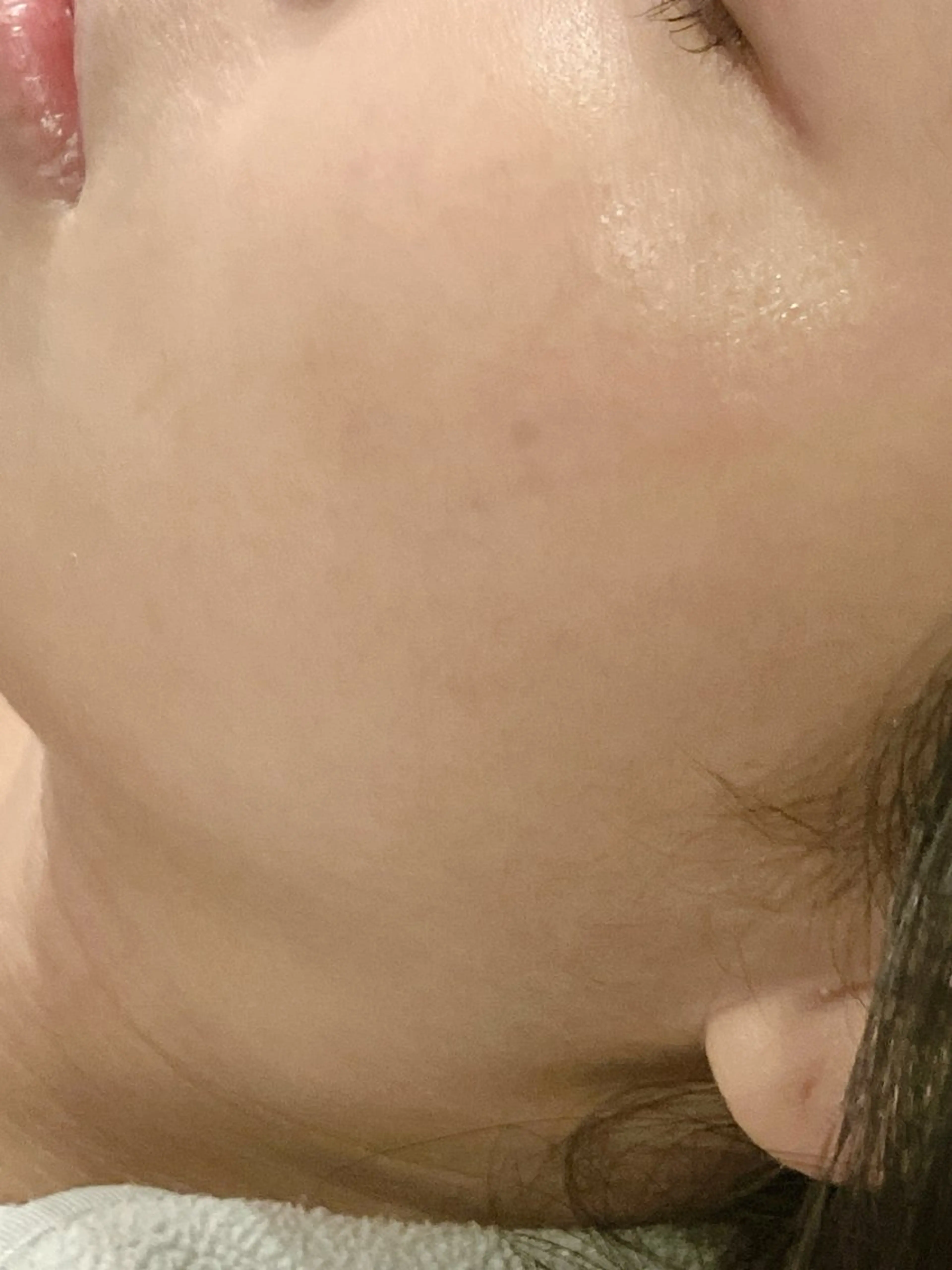 【オプション】ヒト幹細胞炭酸＆成長因子パック《トーンアップ＆引き締め美肌》の写真