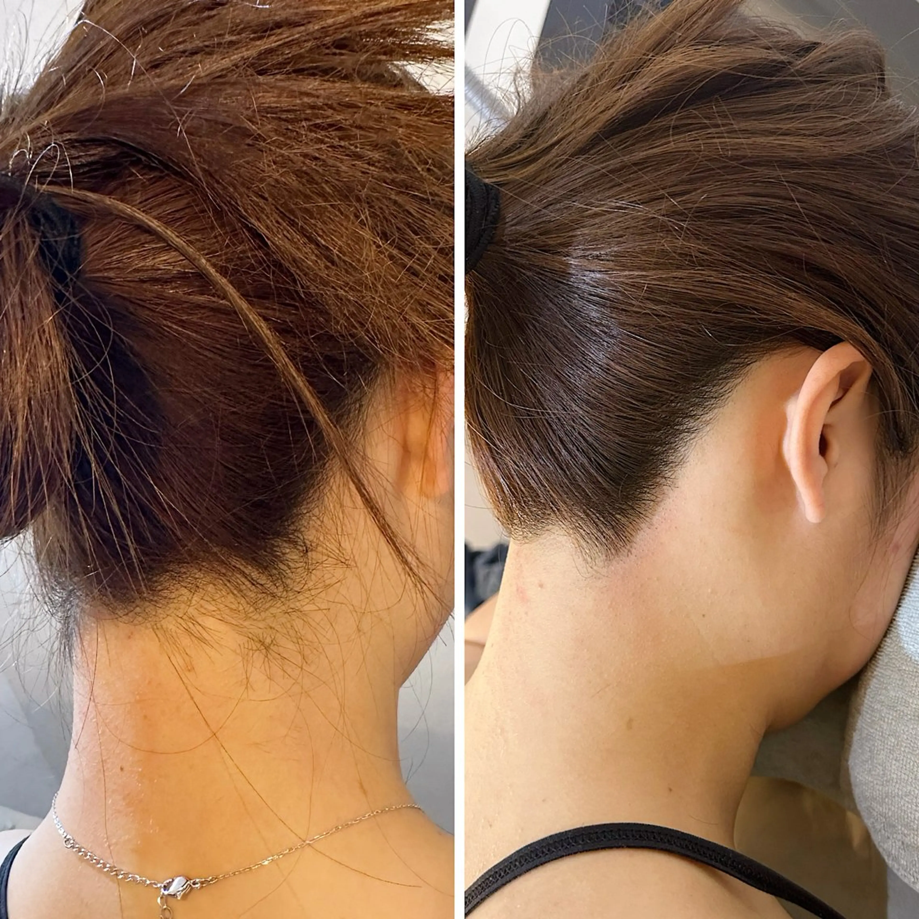 脱毛 うなじ脱毛/美肌脱毛 LABELのエステ・リラクイメージ