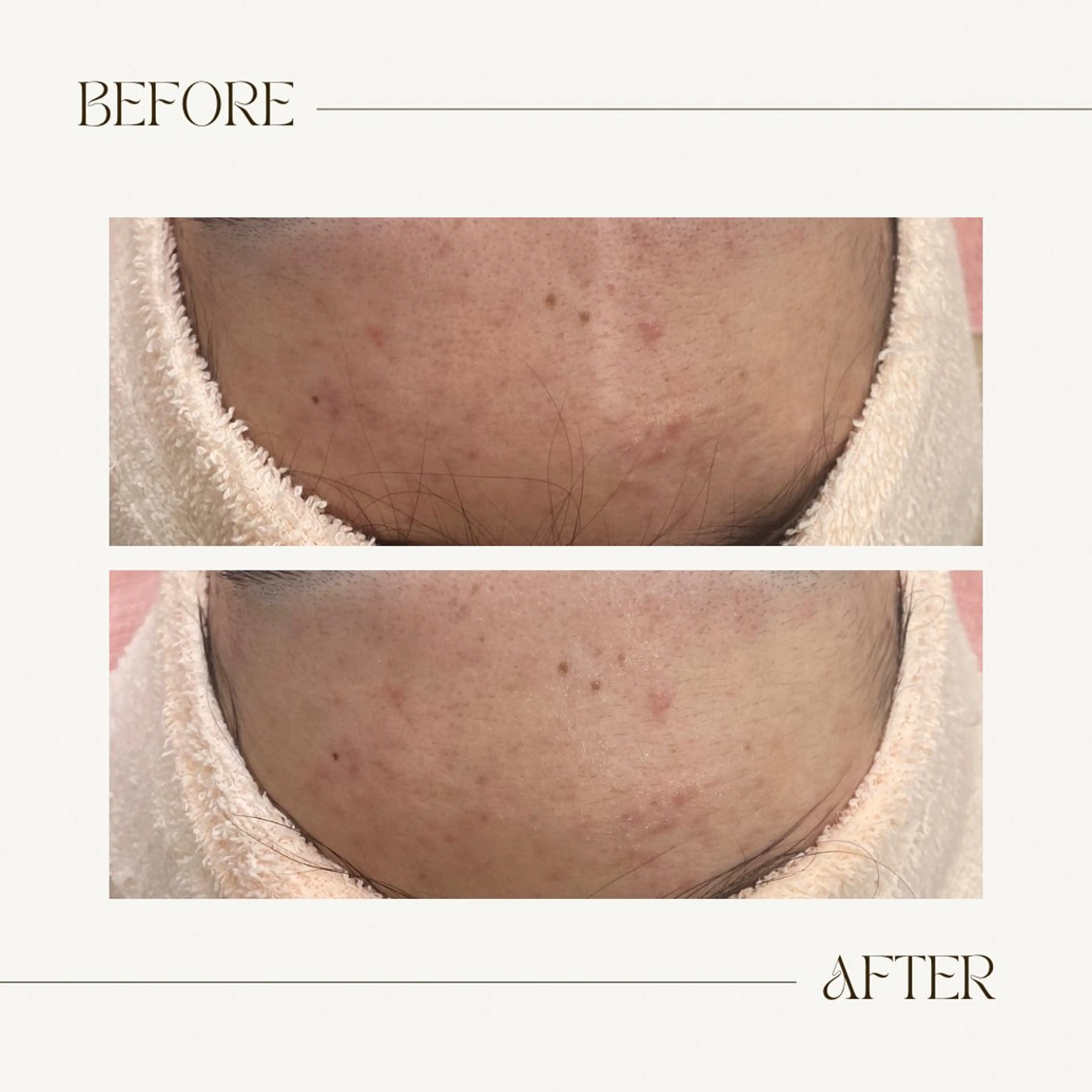 CEsalonEgg 齋藤のエステ・リラクイメージ