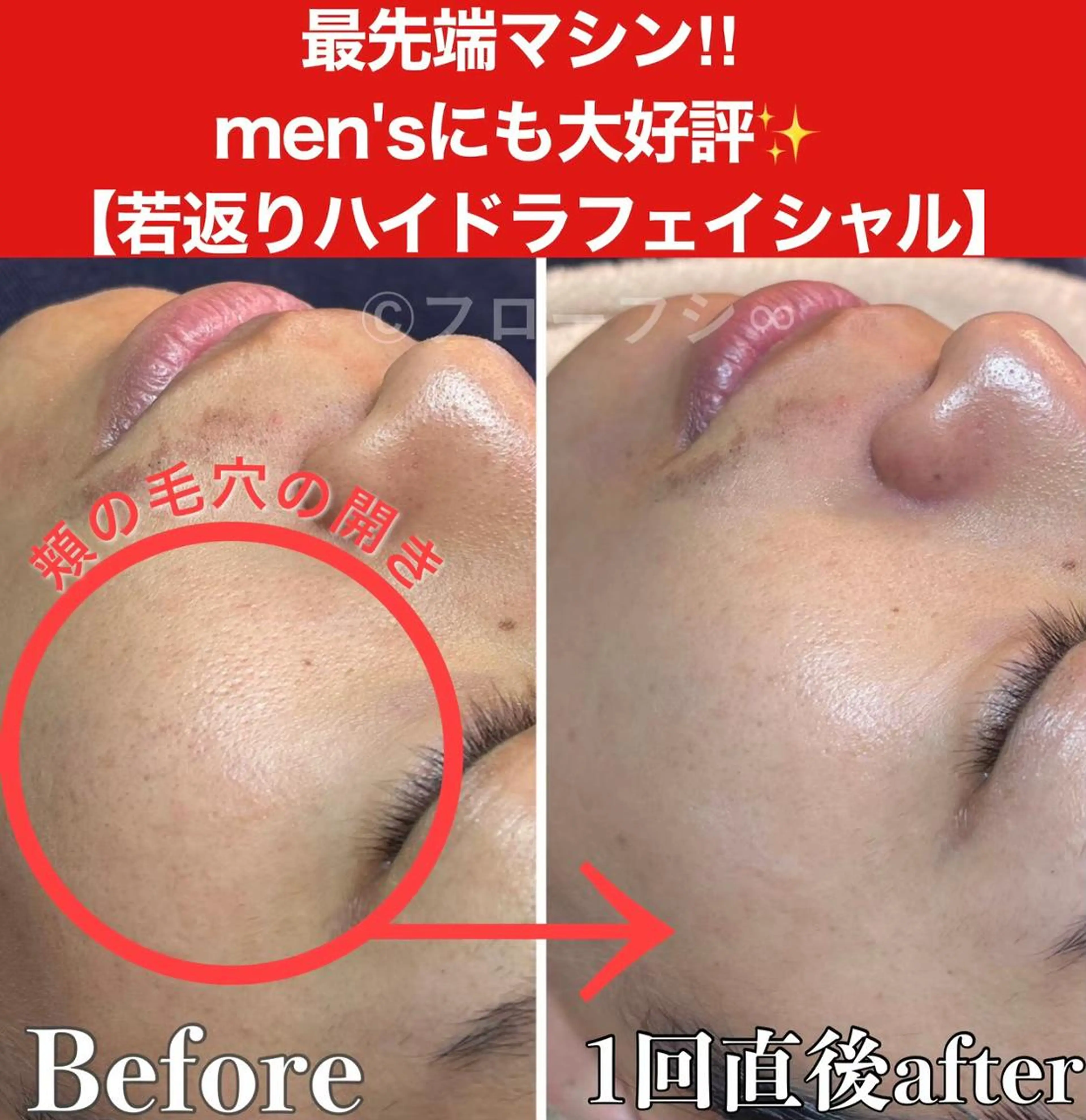 部分痩せ♥️小顔専門 MIKUのエステ・リラクイメージ