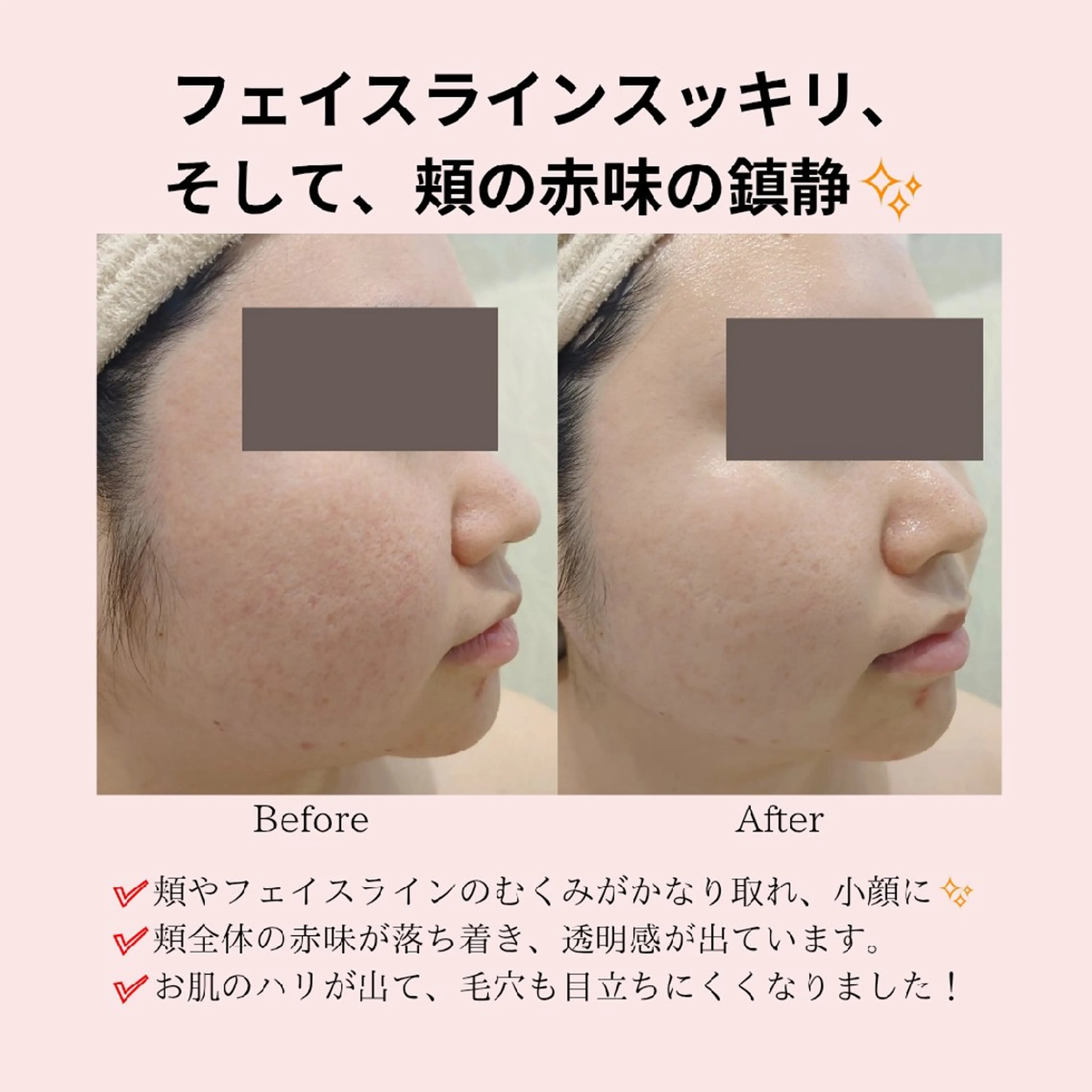 エステ PRETTIEST SHINE所属・山田 浩子のエステ・リラクイメージ