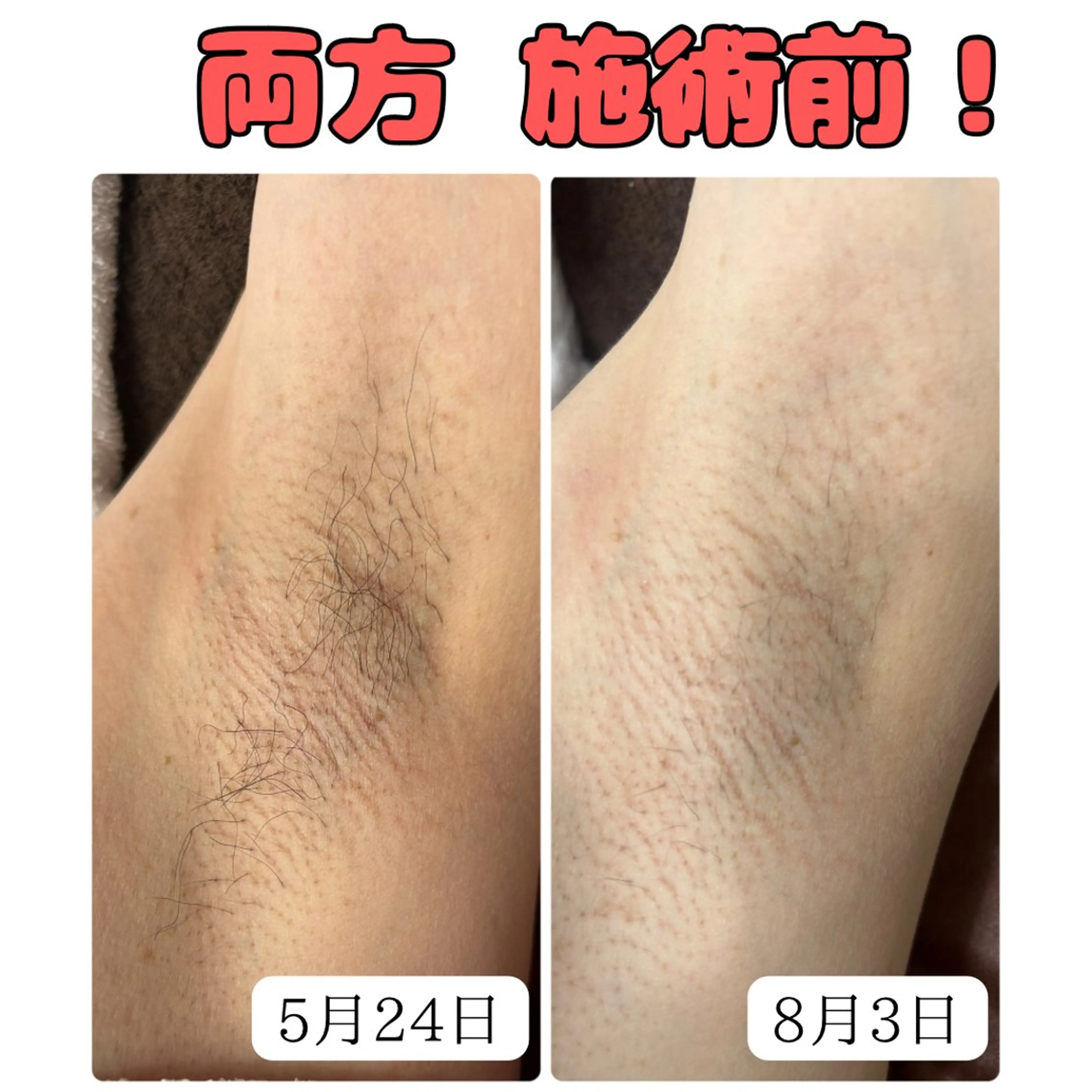 メンズ キッズ 脱毛 STELLAR. 谷岡恵里香のエステ・リラクイメージ