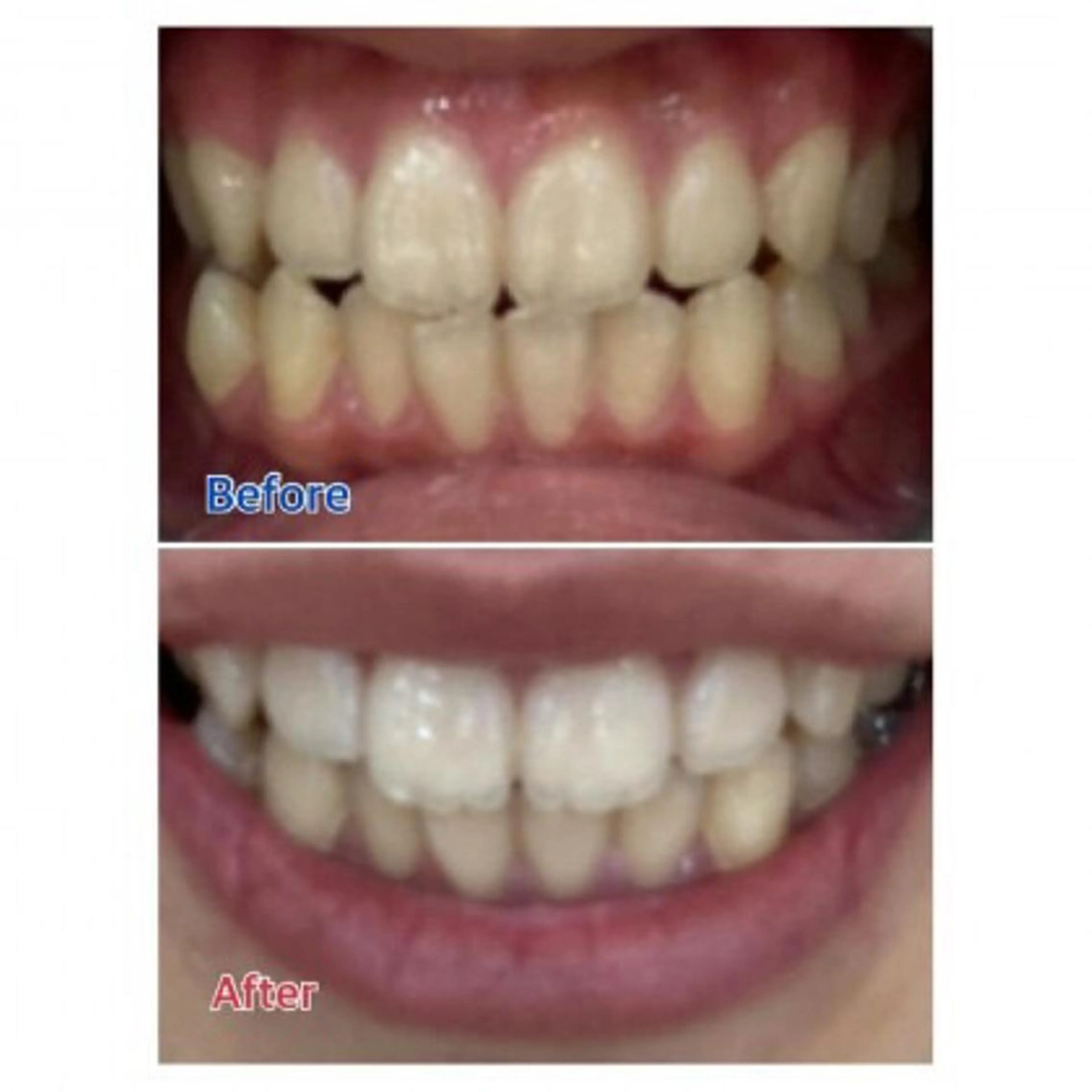 M渋谷店所属・Ｍ渋谷 ホワイトニングのエステ・リラクイメージ