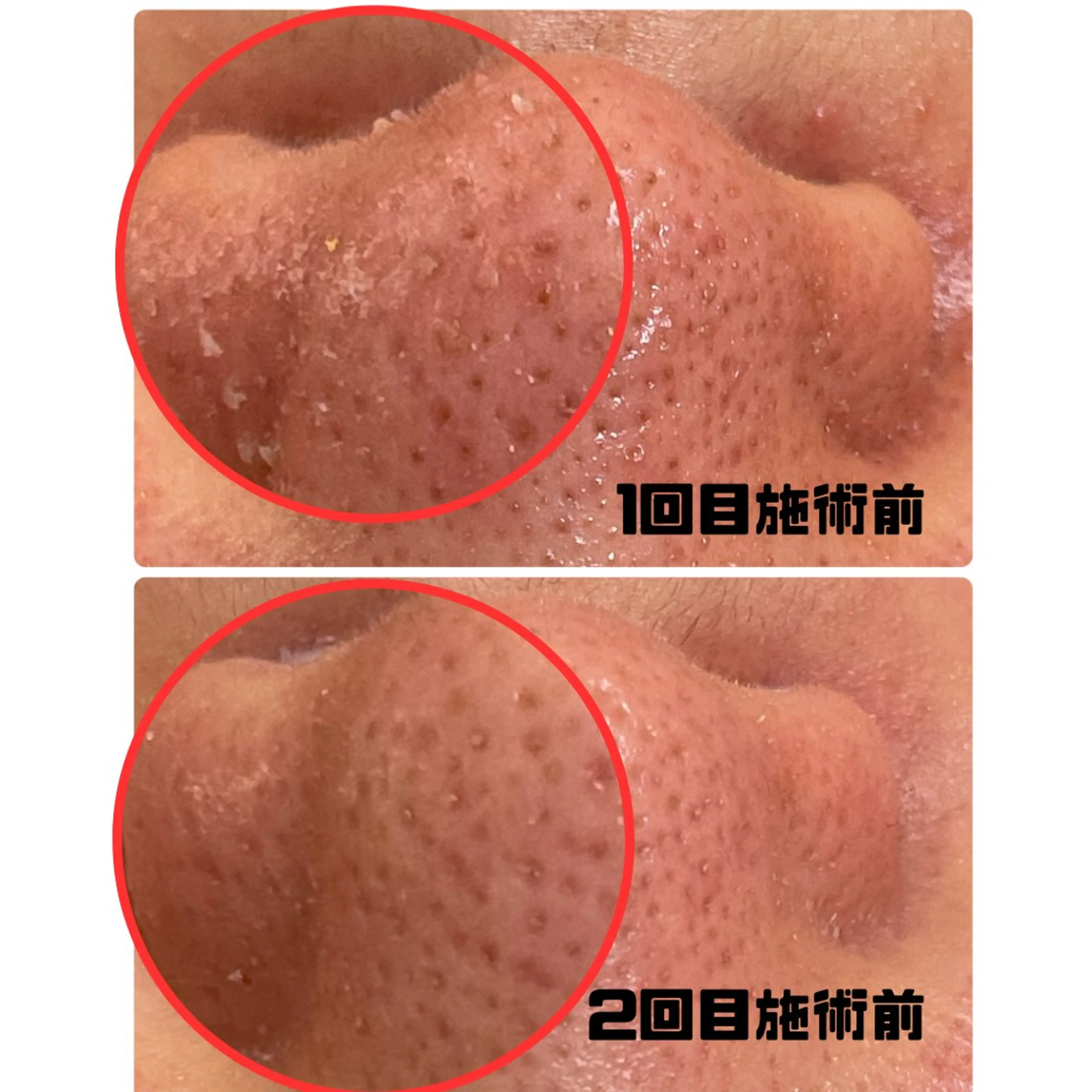 肌質改善専門店/絹々(きぬ)所属・心満たされる ハーブピーリング絹々のエステ・リラクイメージ