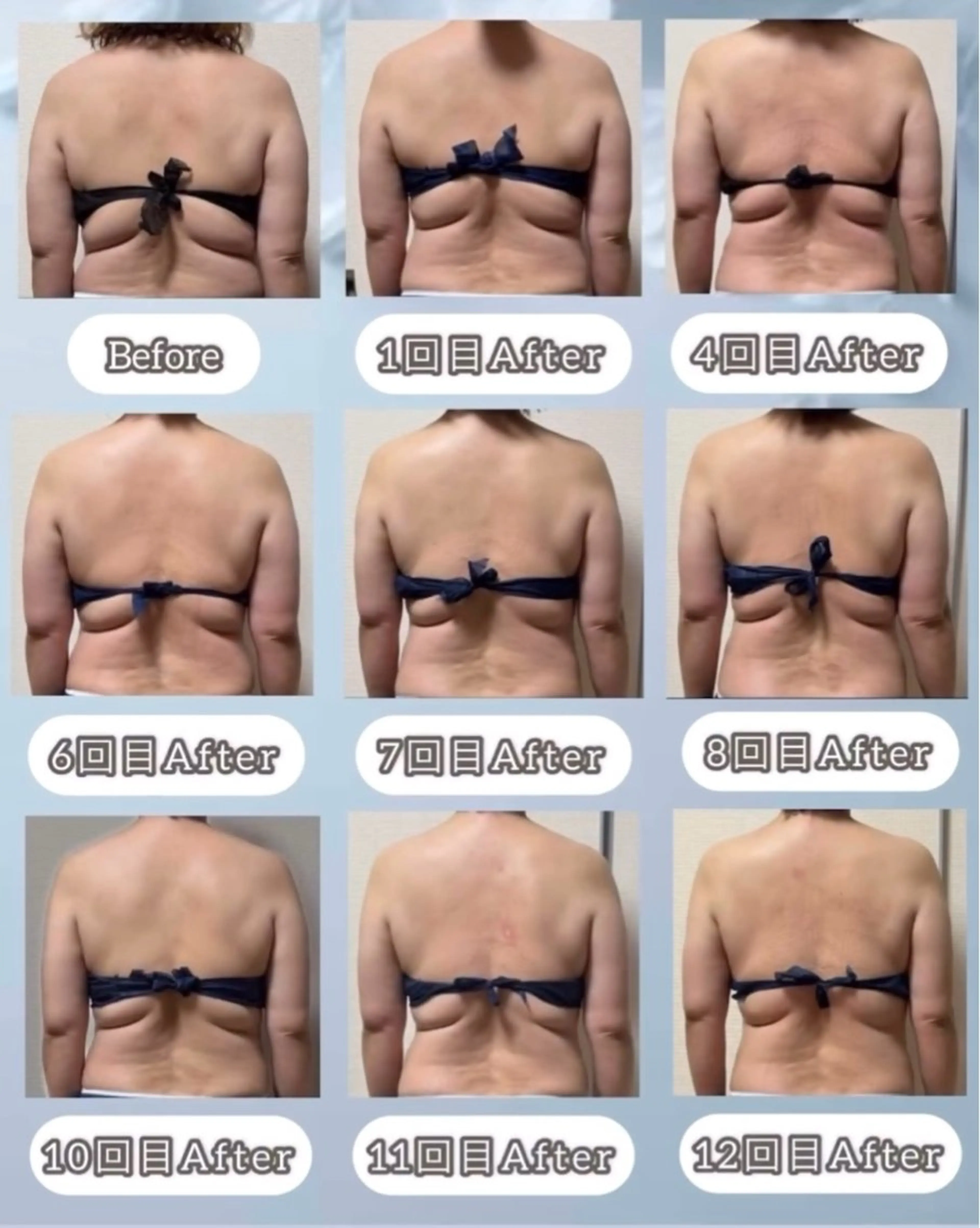 エステ ヴィーナス ビューティーのエステ・リラクイメージ