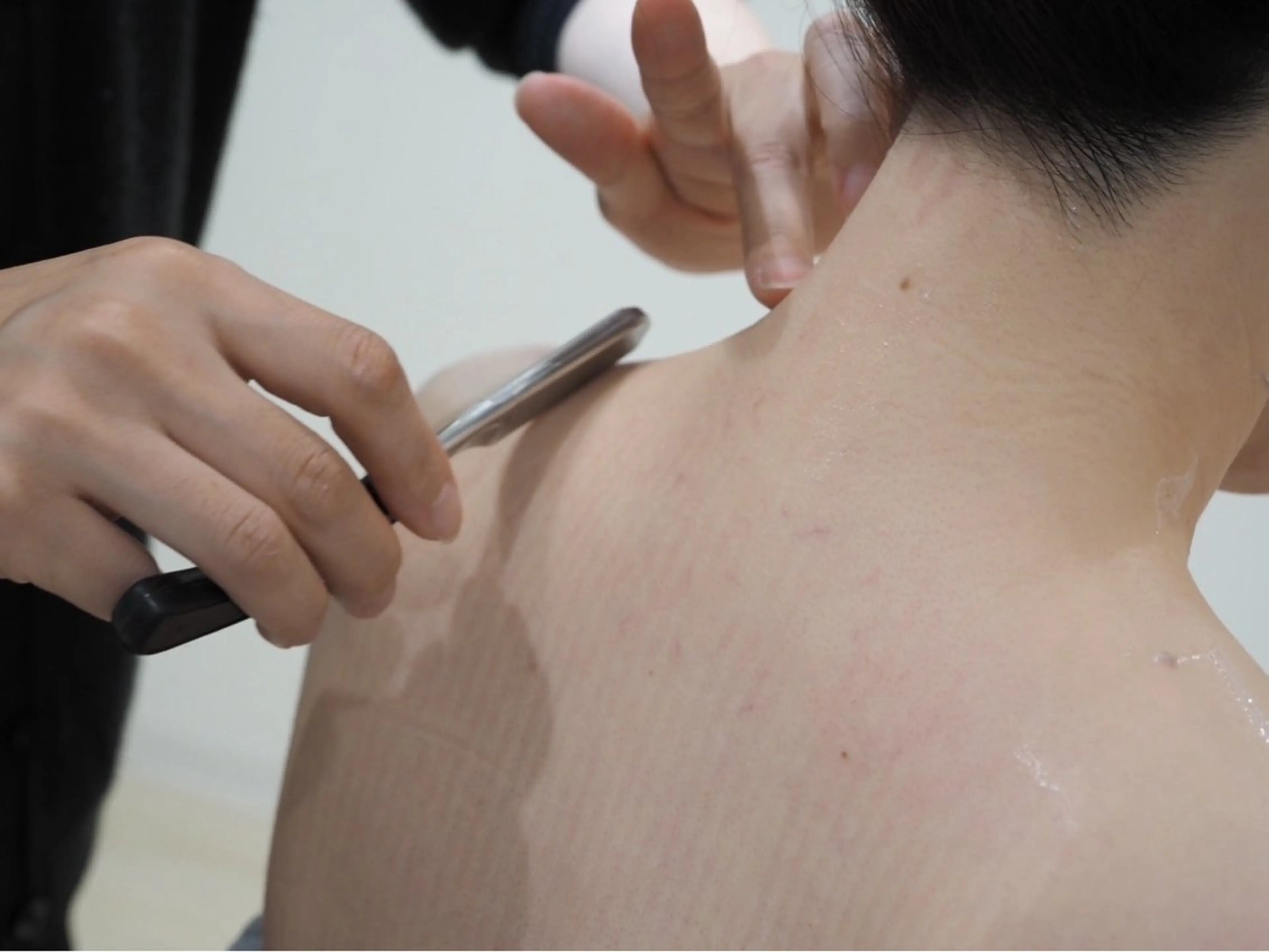 脱毛中の方、ご自身では剃りにくい箇所の事前処理お手伝いしますの写真