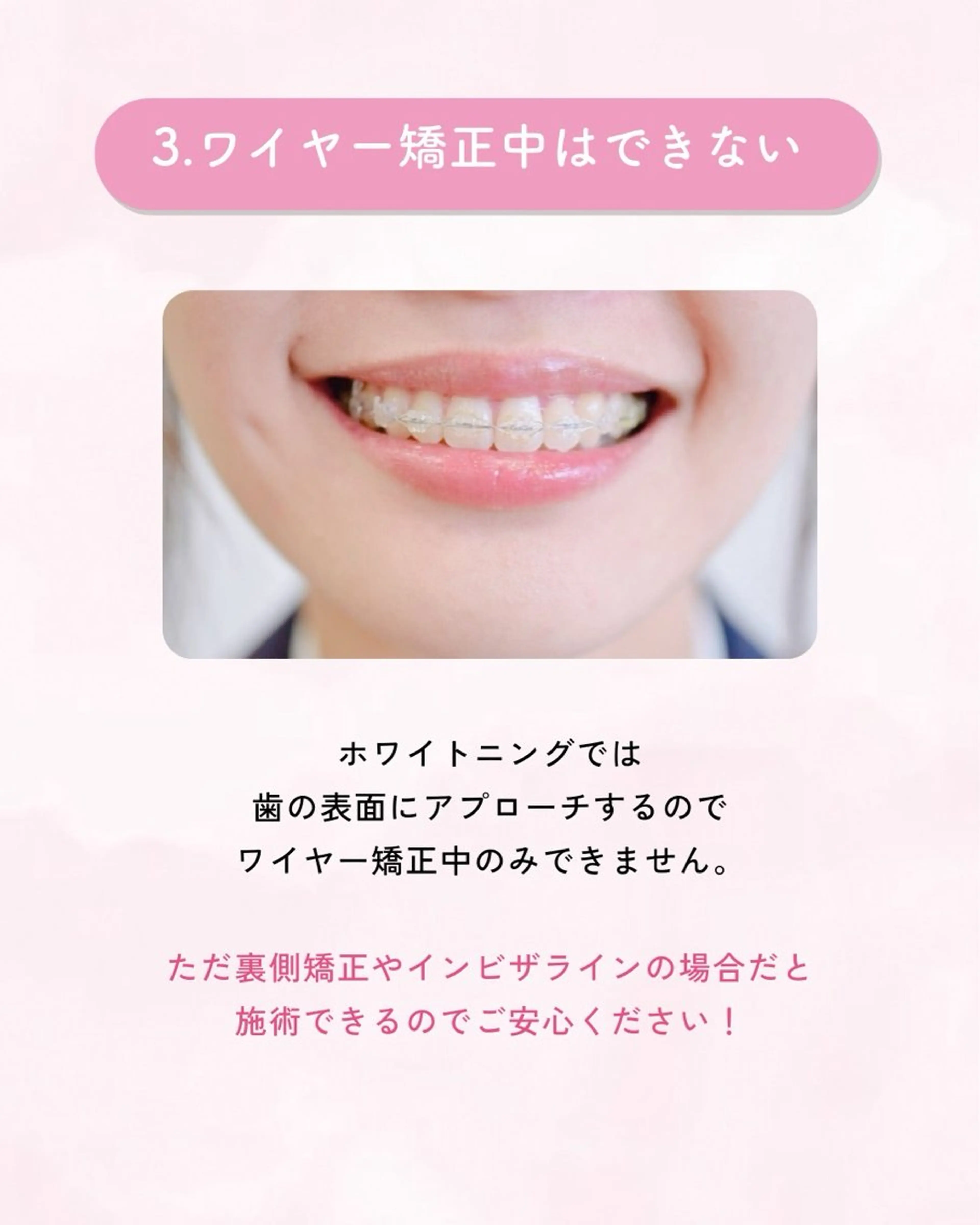 セルフホワイトニング エクシア大曽根店のその他イメージ