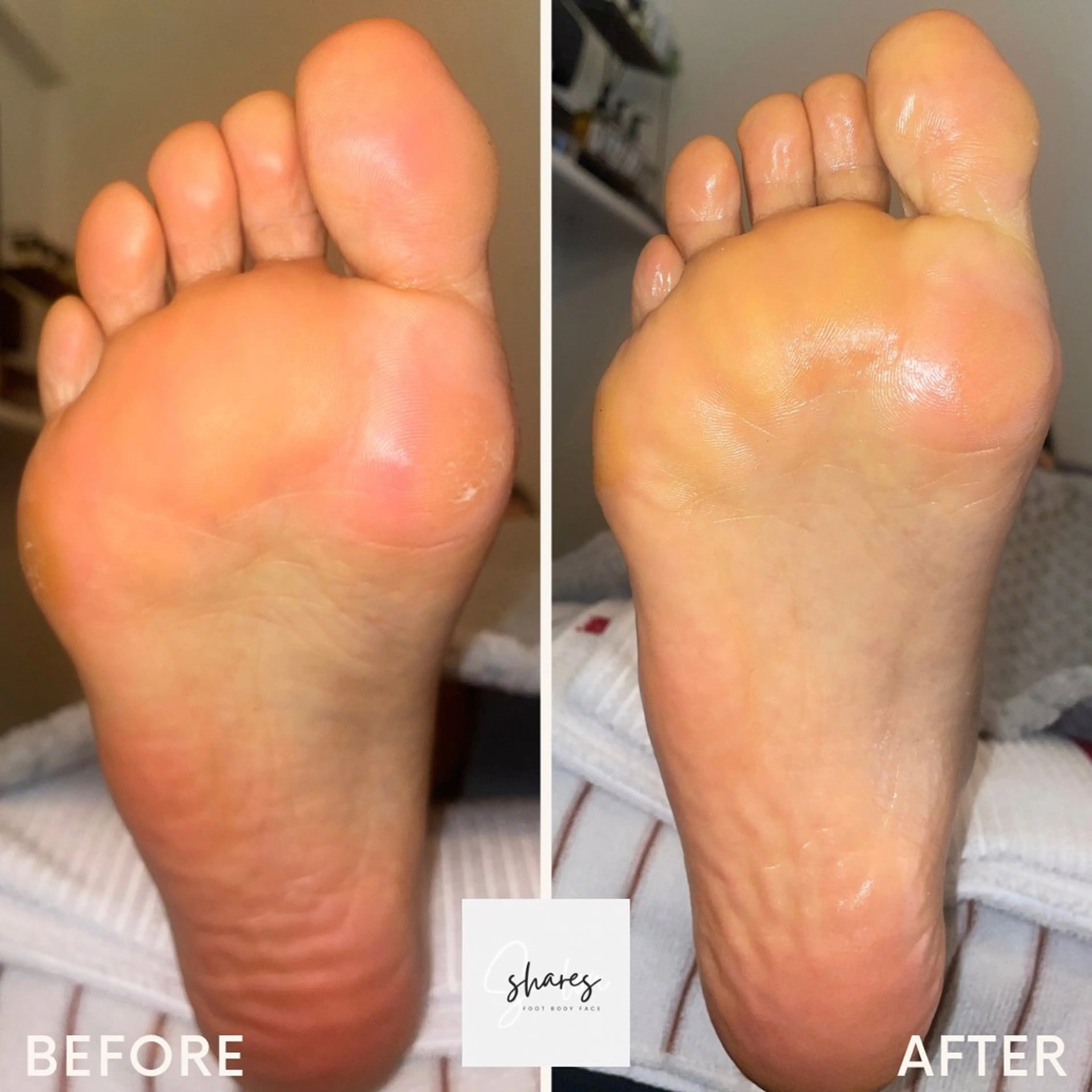 SHARES MADOKAのエステ・リラクイメージ