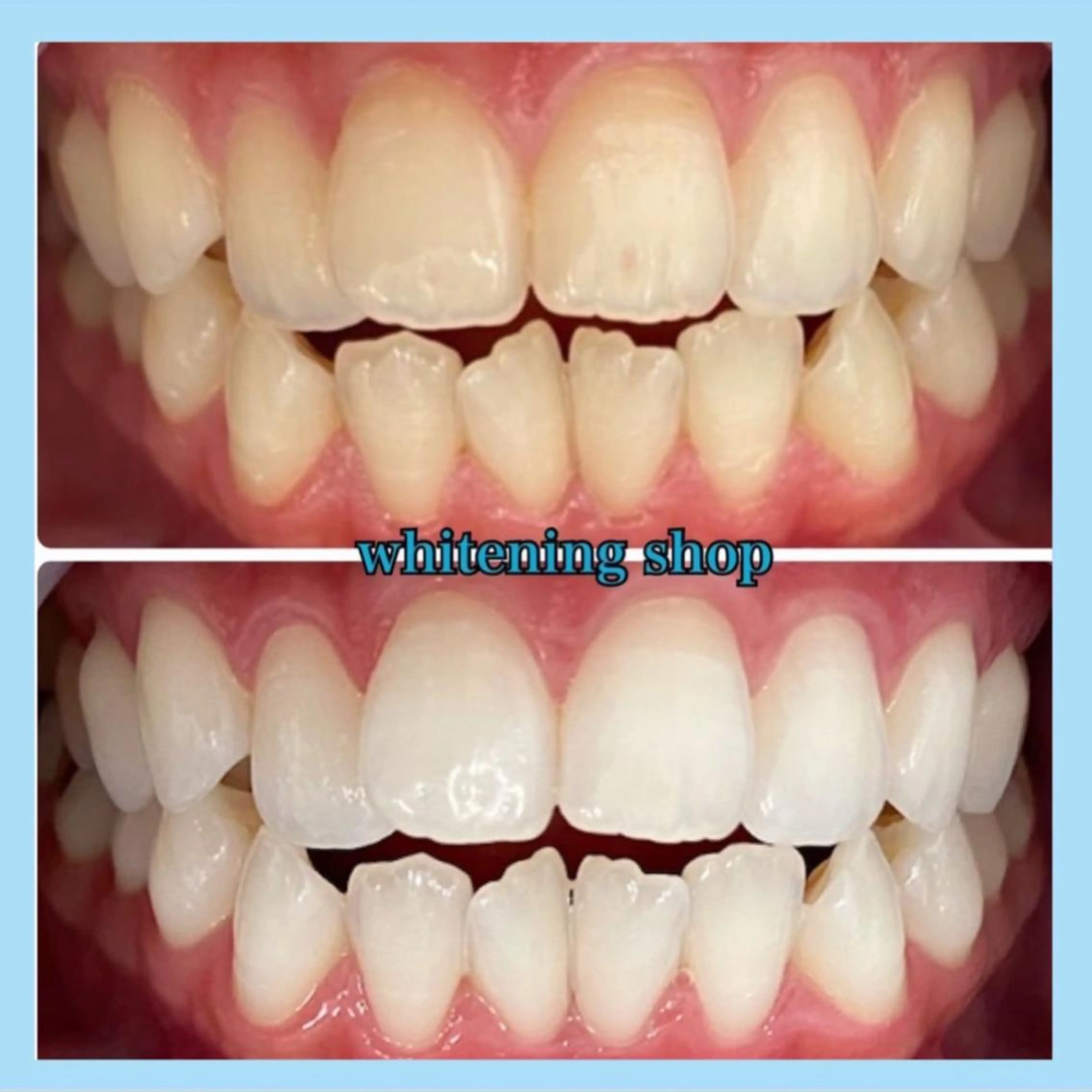 ホワイトニング ショップ千葉店のその他イメージ