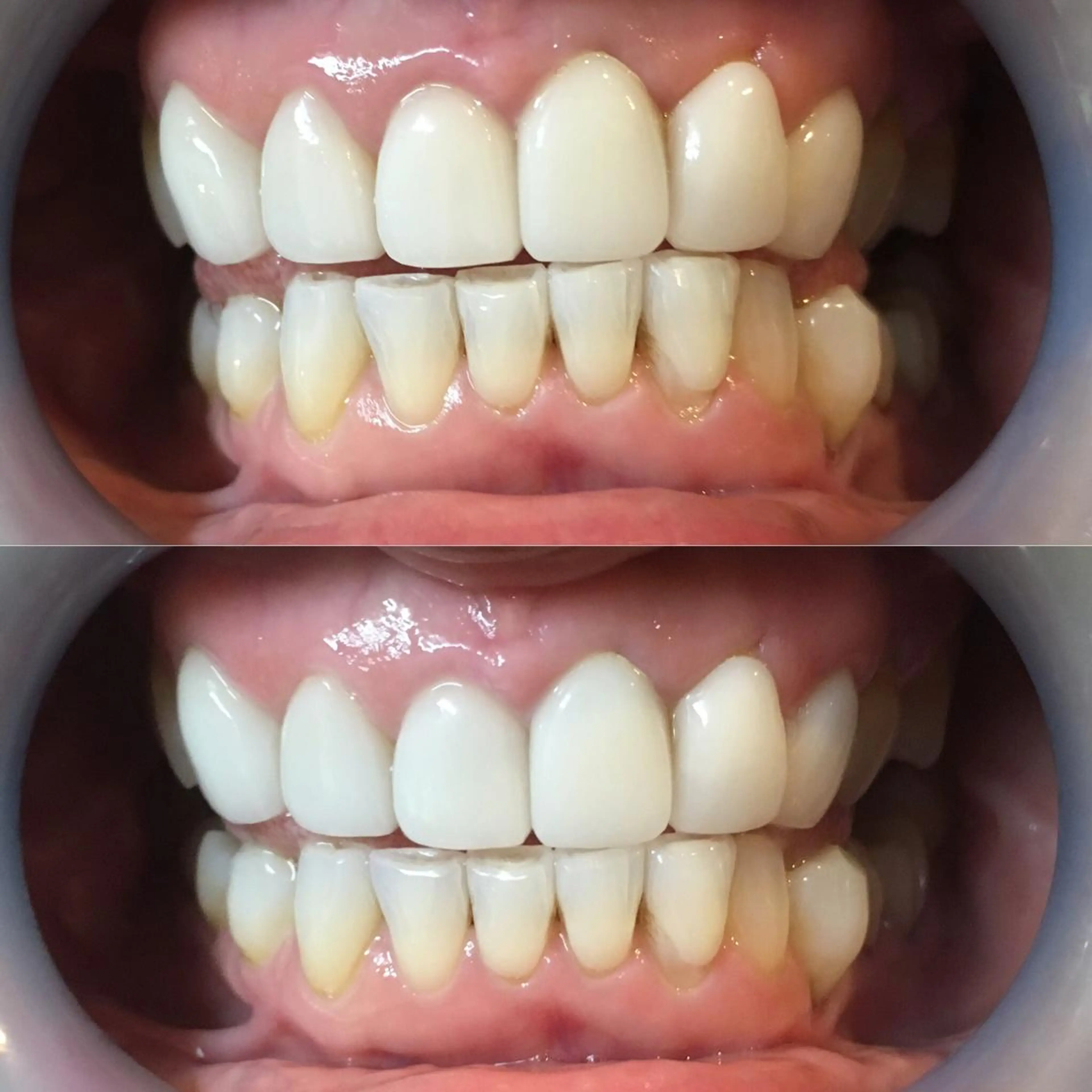 LBSホワイトニング 新宿店💝店長熊倉のその他イメージ